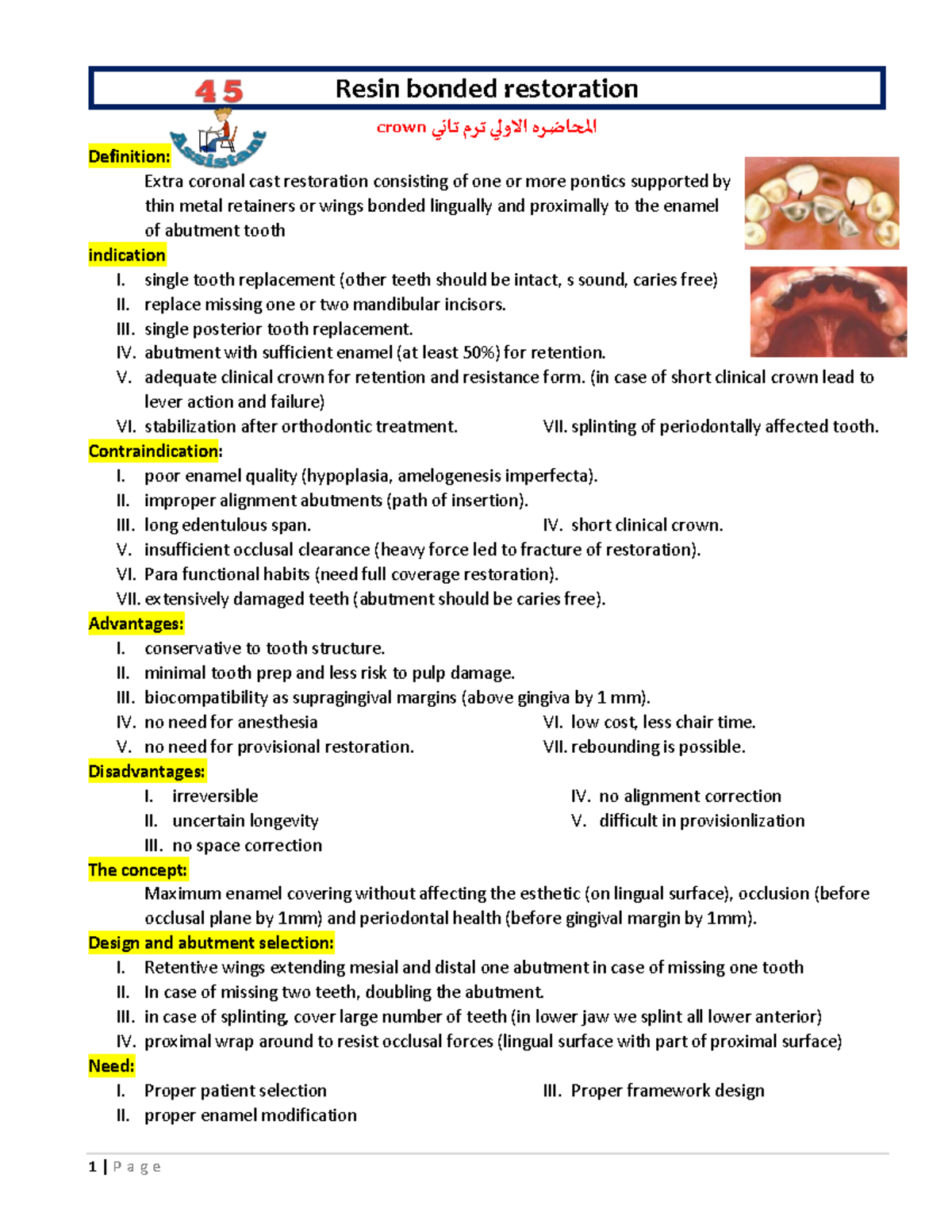 01 Resin bonded restoration Resin bonded restoration crown المحاضره
