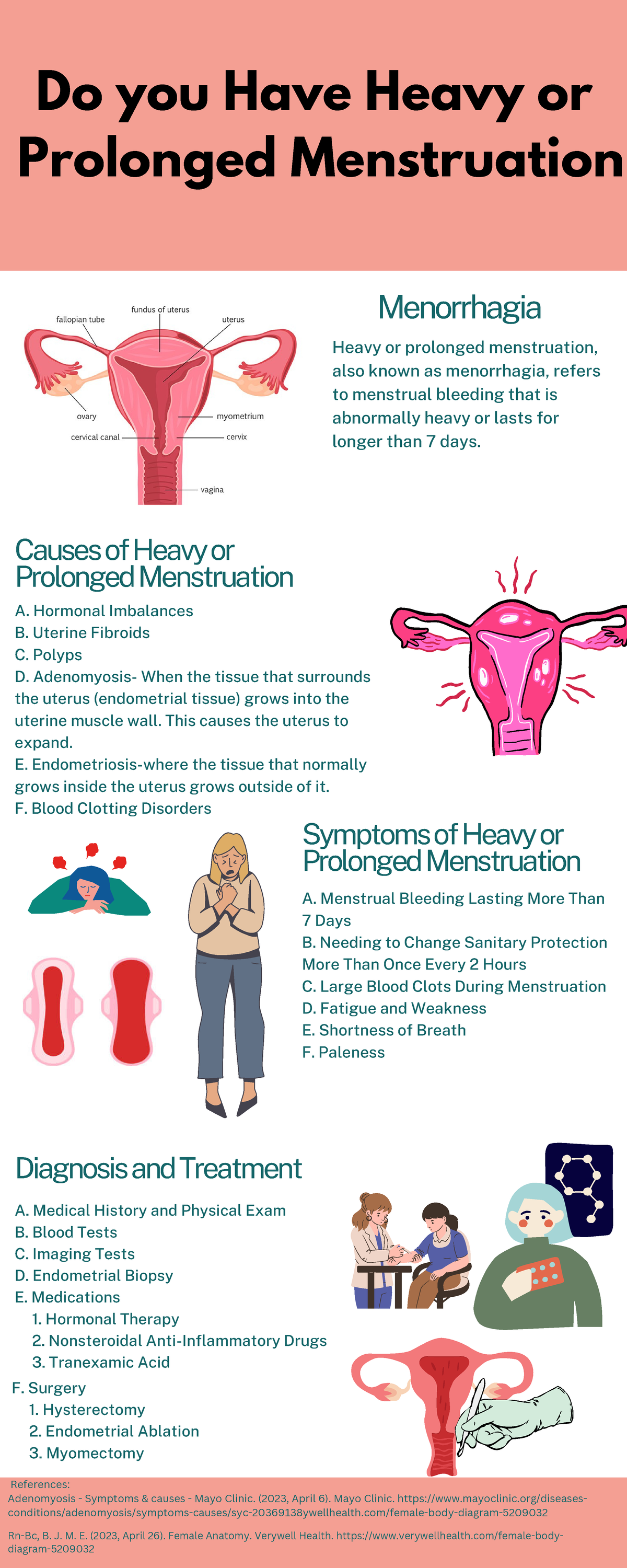 Endometriosis - Symptoms and causes - Mayo Clinic