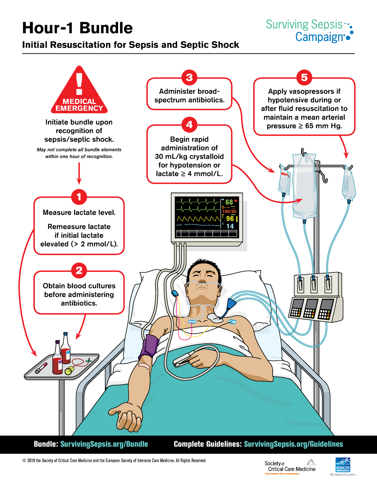 sepsis case study uk