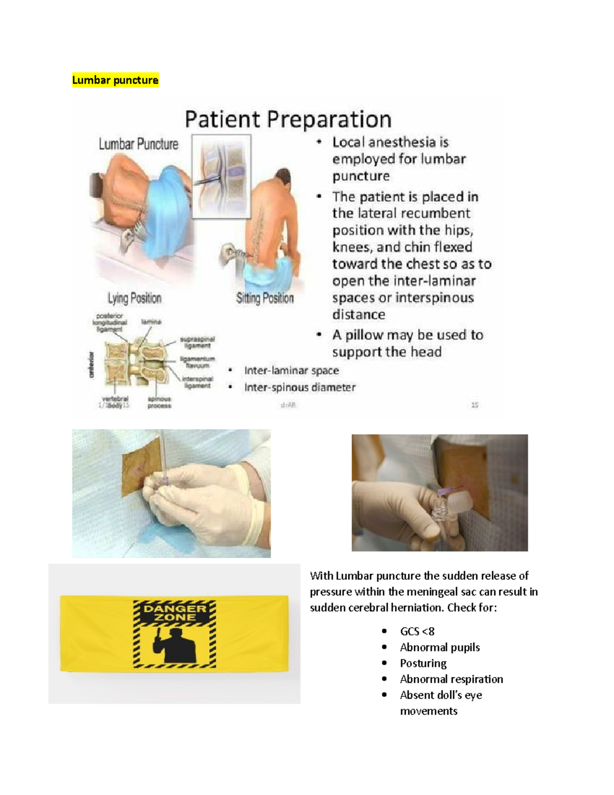 MS exam 4 study guide med surge lectures notes with pictures Lumbar