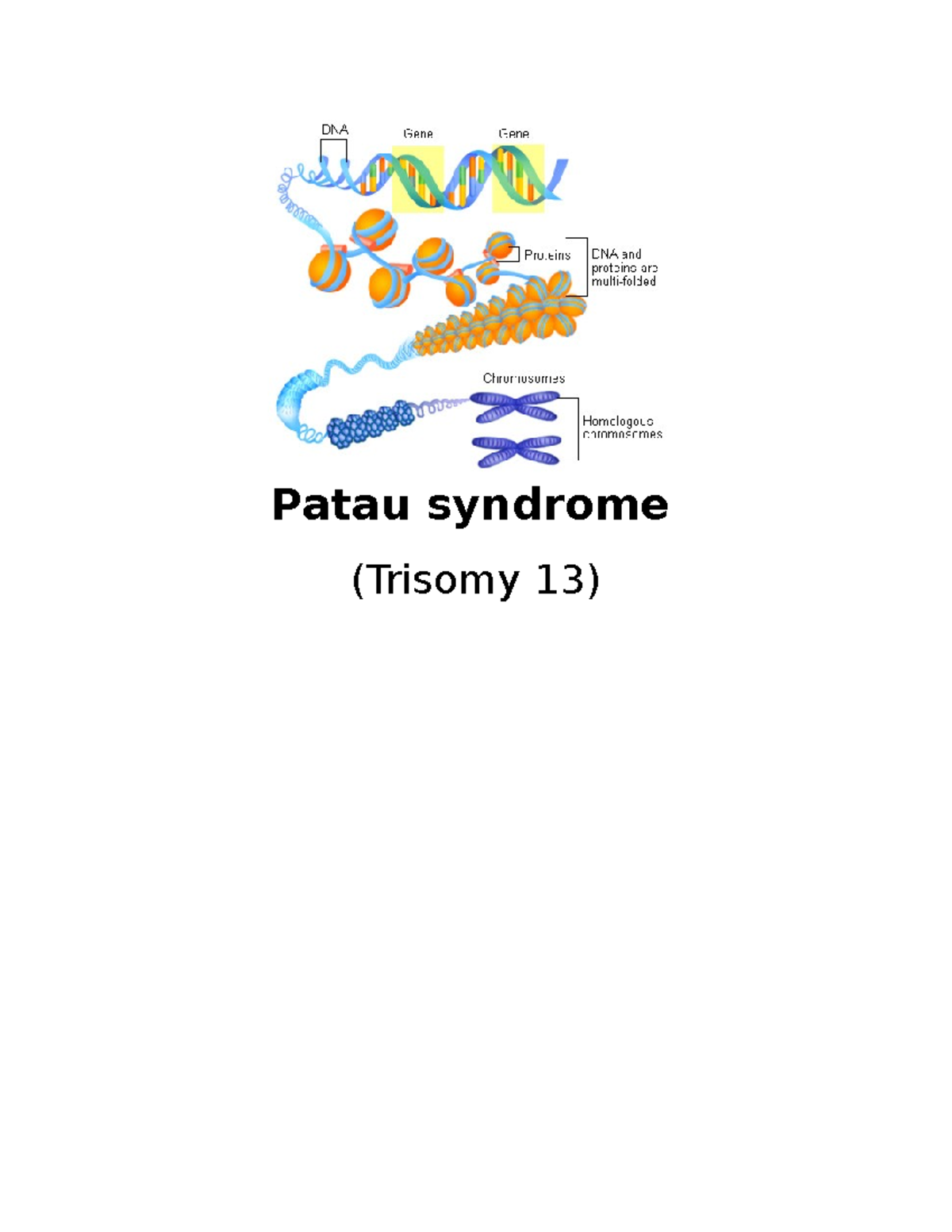 Trisomy 13 Term Project- Copy - Patau syndrome (Trisomy 13 ...