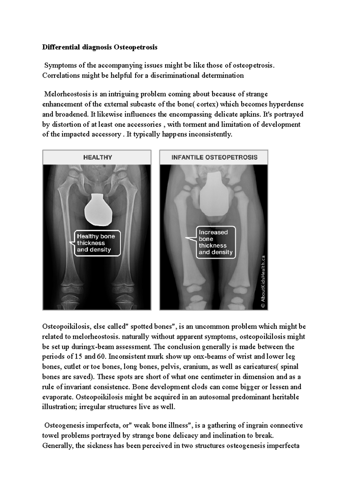 Treatment and Differential diagnosis Osteopetrosis - Differential ...