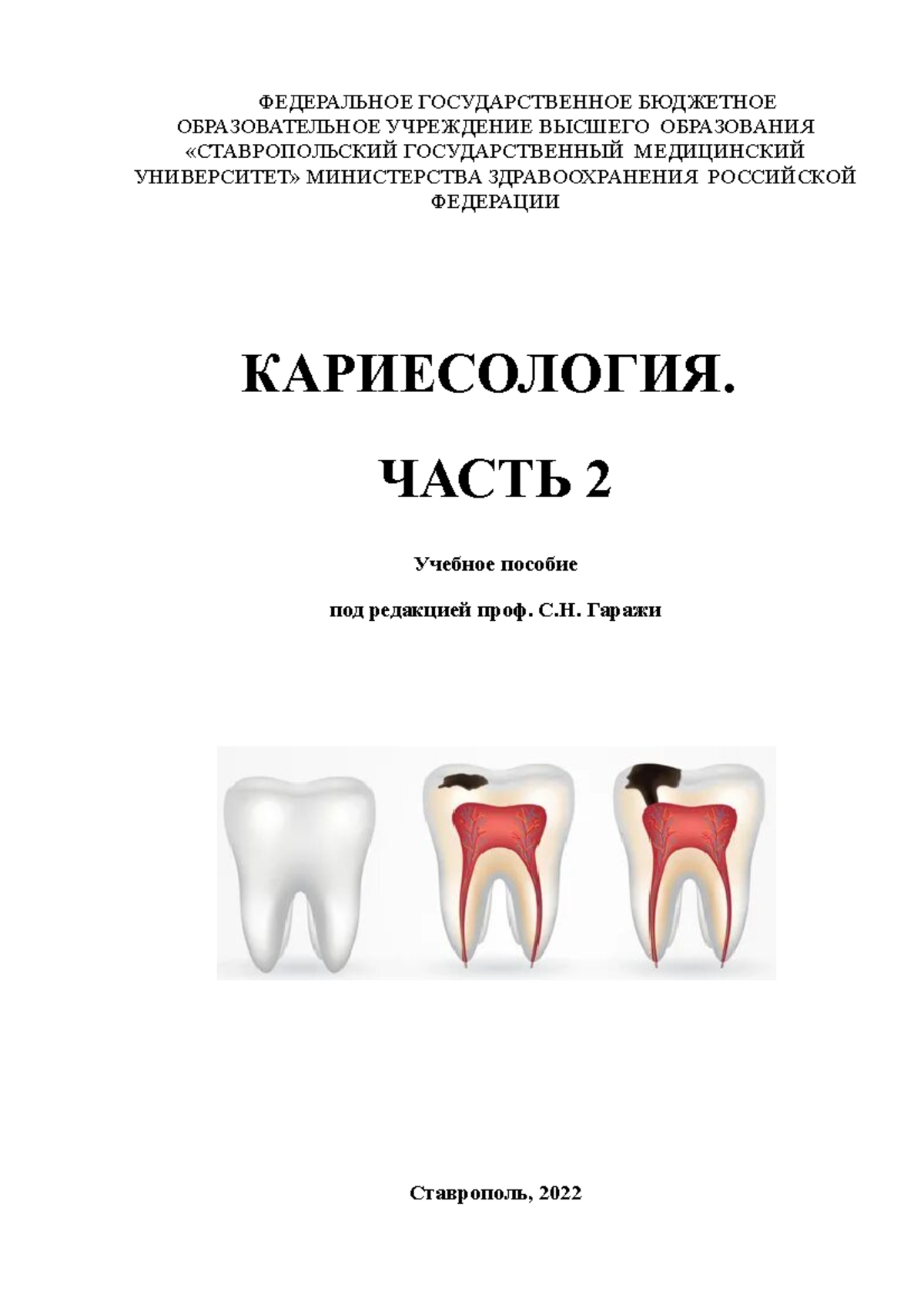 Отделку пломбы из стеклоиономерного цемента следует проводить через