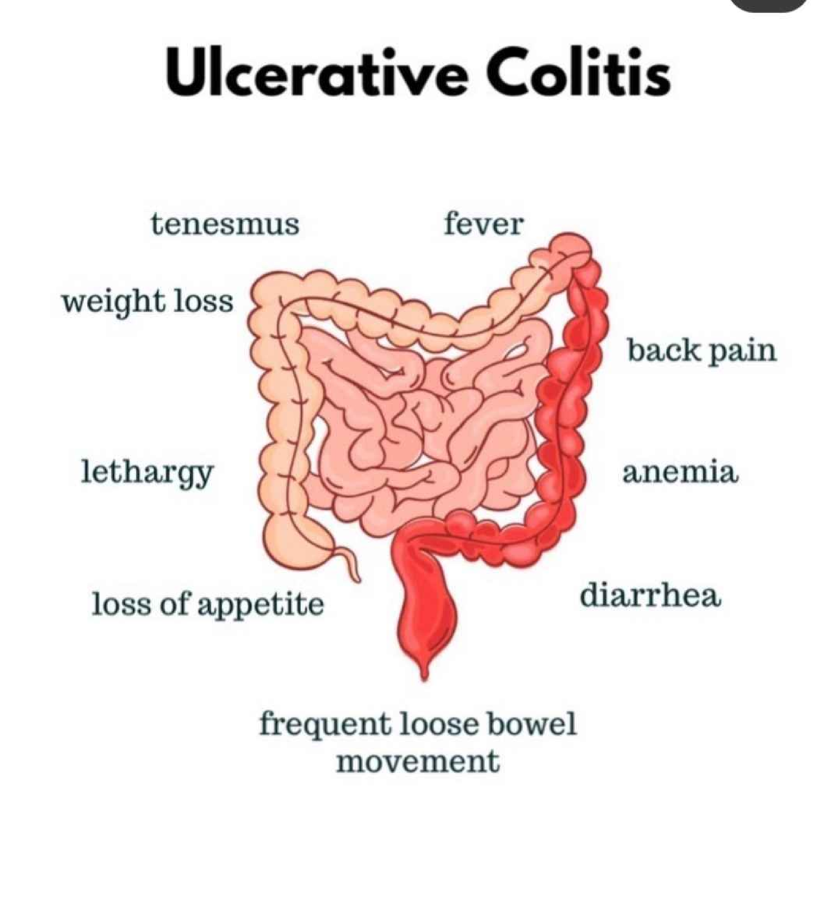 Mnemonics - Anatomy, Embeyology, Arthology, Angiology - Studocu