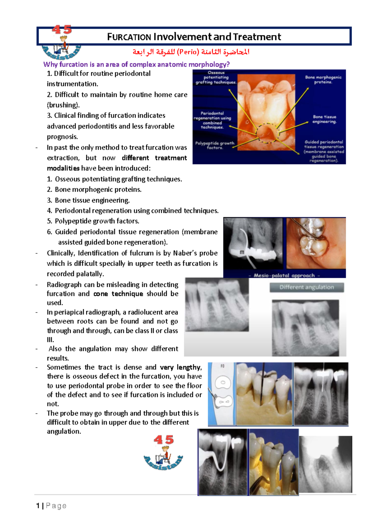 08 Furcation involvement and treatment FURCATION I nvolvement a nd T