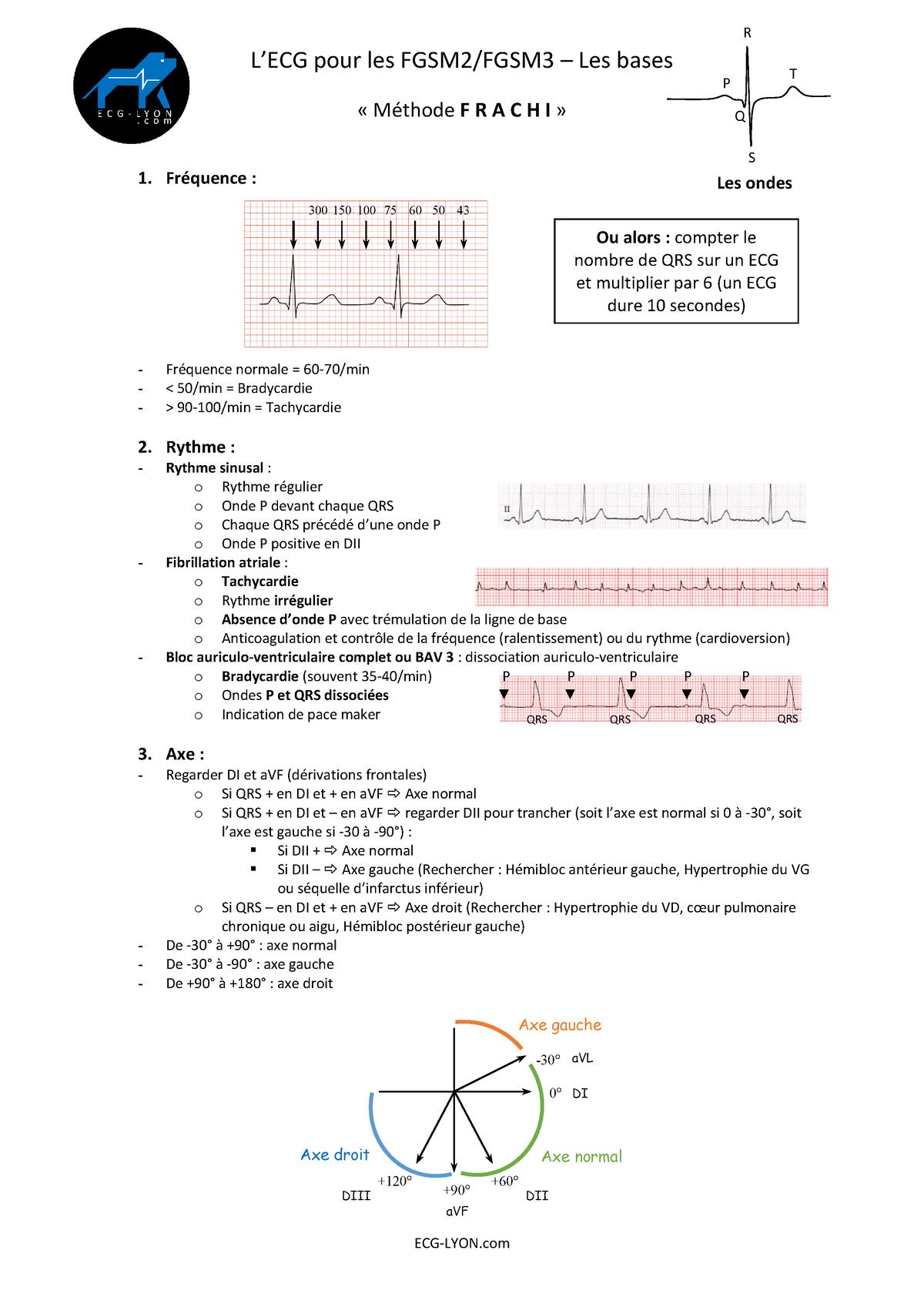 Ecg P2 Fiche Dinterprétation Decg Ecg Lyon Lecg Pour Les Fgsm2fgsm3 Les Bases 4703