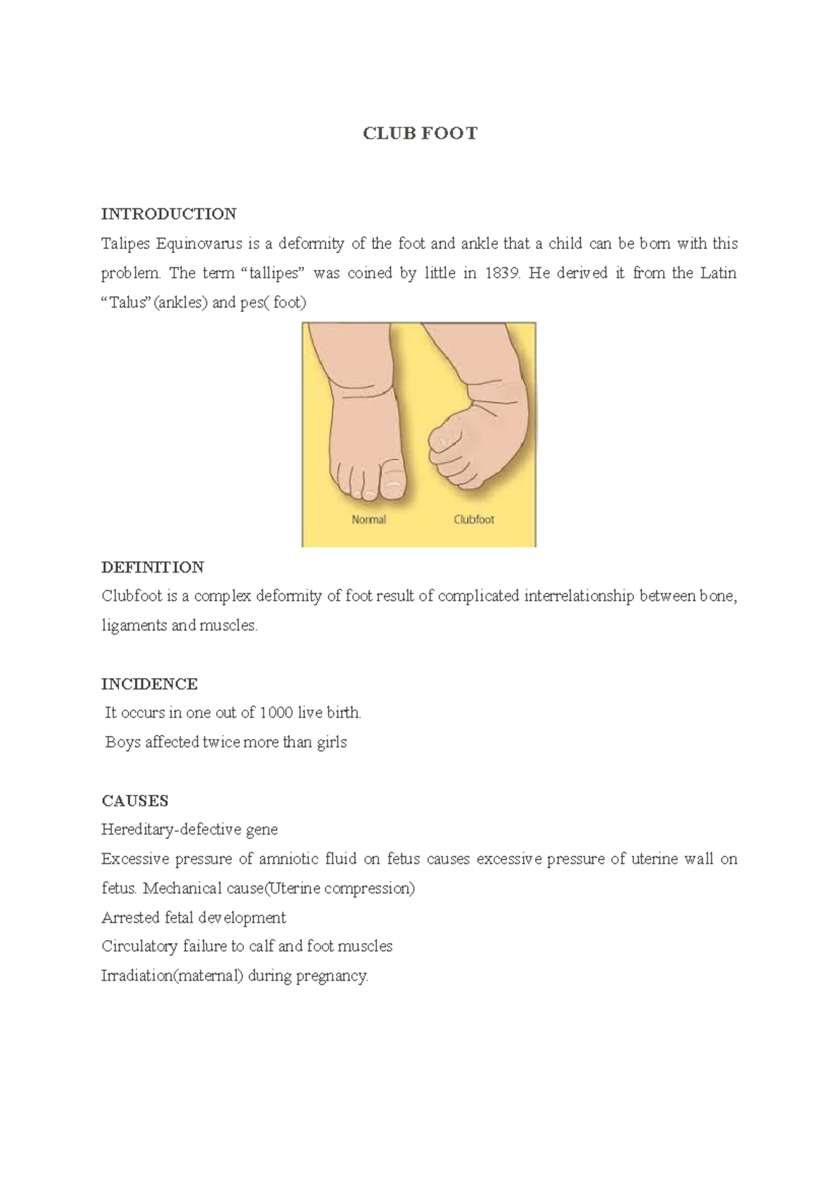 CLUB FOOT jasmine ouseph CLUB FOOT INTRODUCTION Talipes Equinovarus