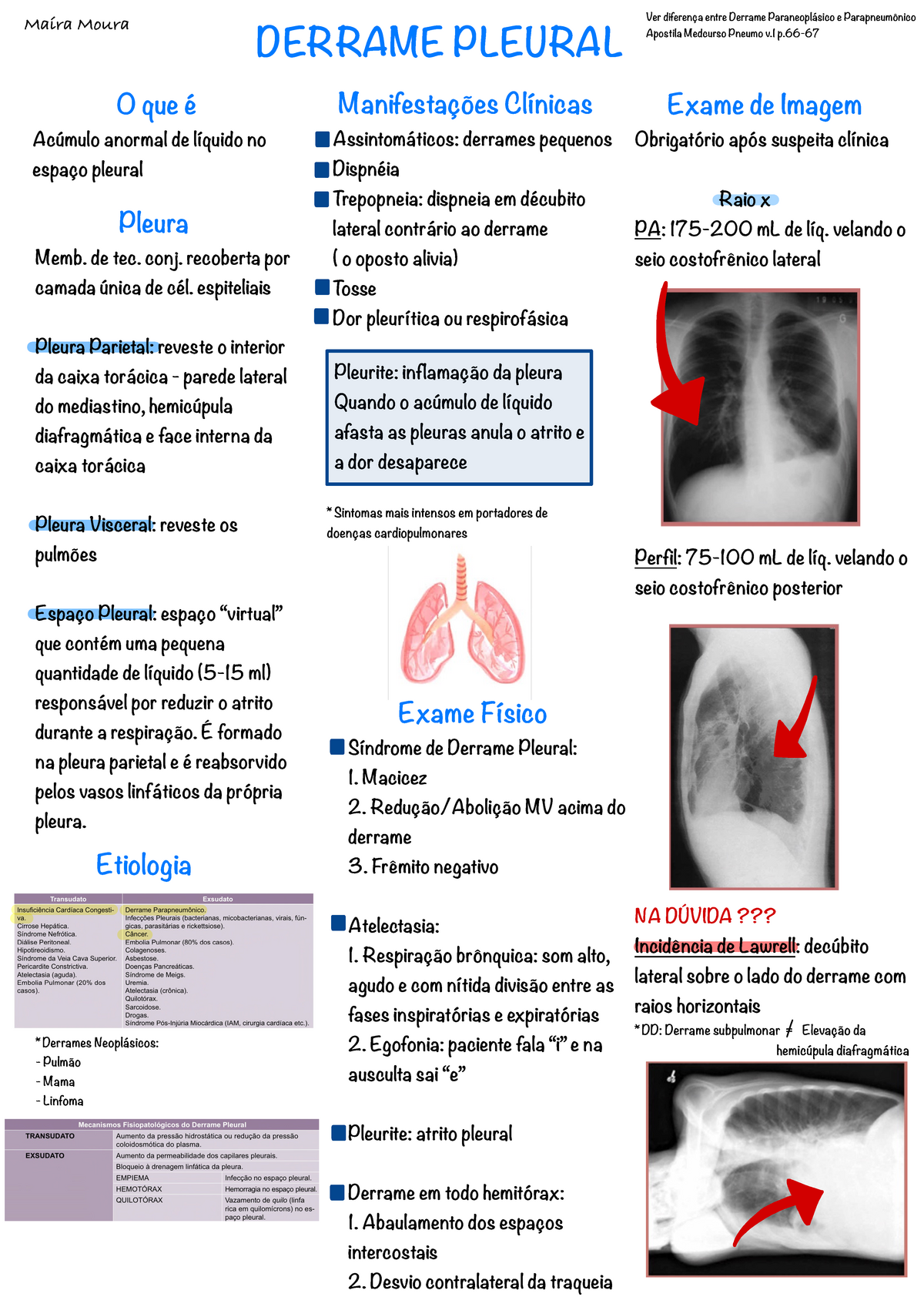 Resumo Derrame Pleural Derrame Pleural O Que Ac Mulo Anormal De