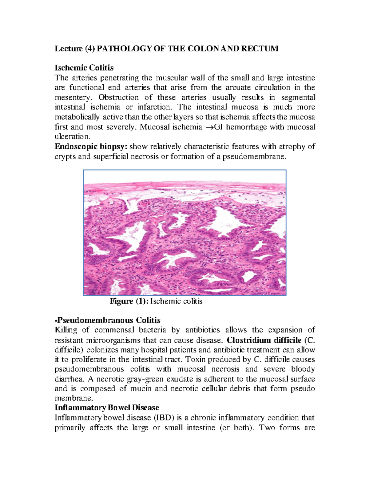 GIT pathology-Pathology of Colon and rectum - Lecture (4) PATHOLOGY OF ...