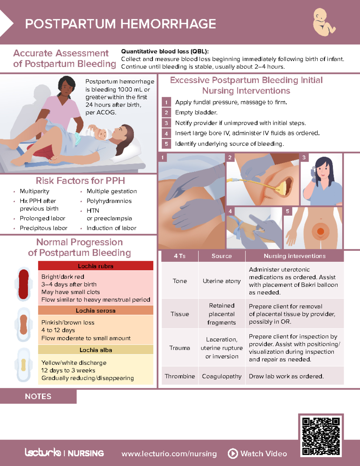 Nursing CS Postpartum-Hemorrhage 02 - lecturio/nursing Watch Video ...