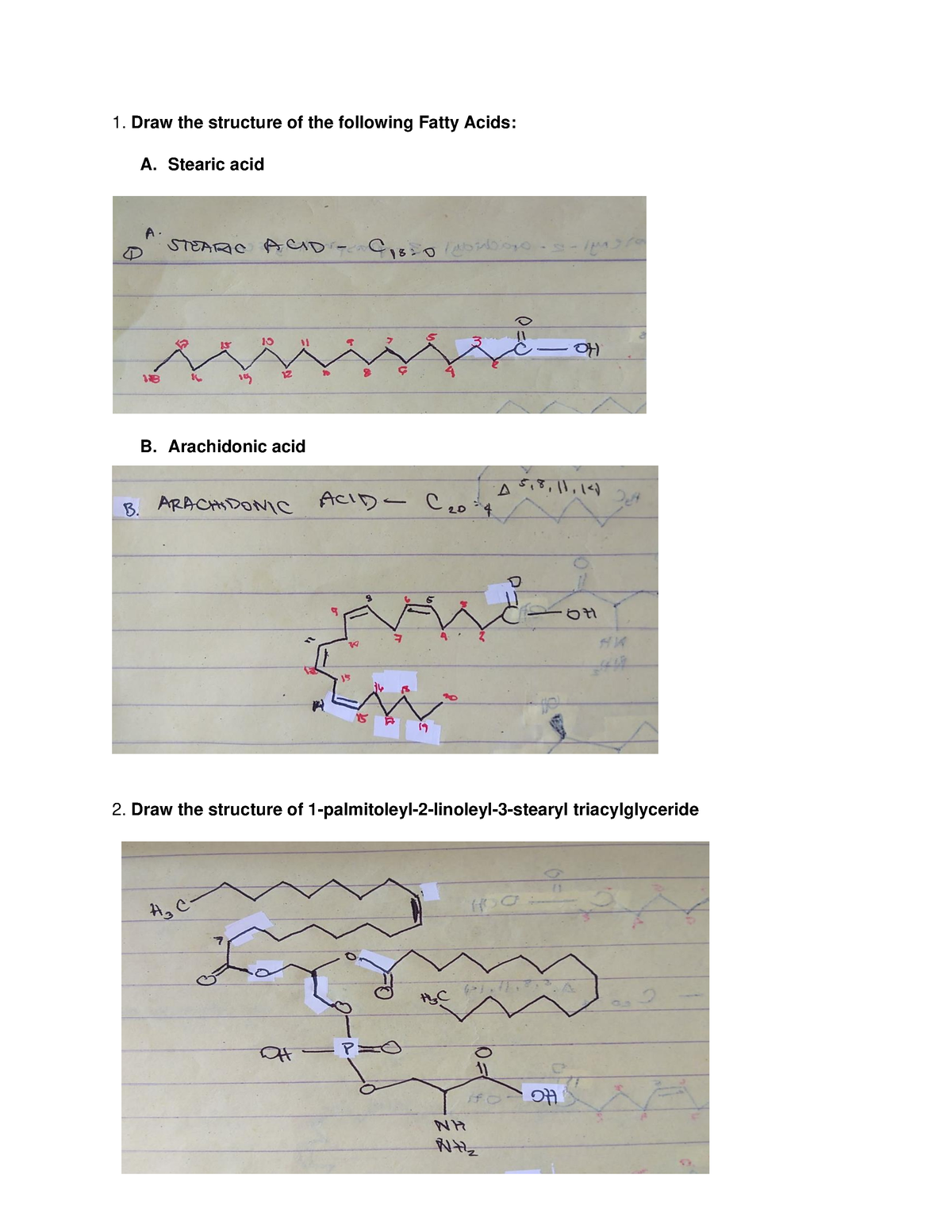 Which of these structures is stearic acid?