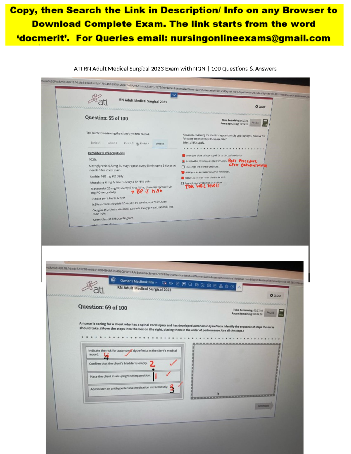 ATI RN Adult MedSurg Proctored Exam 20232024 with NGN 100 Actual