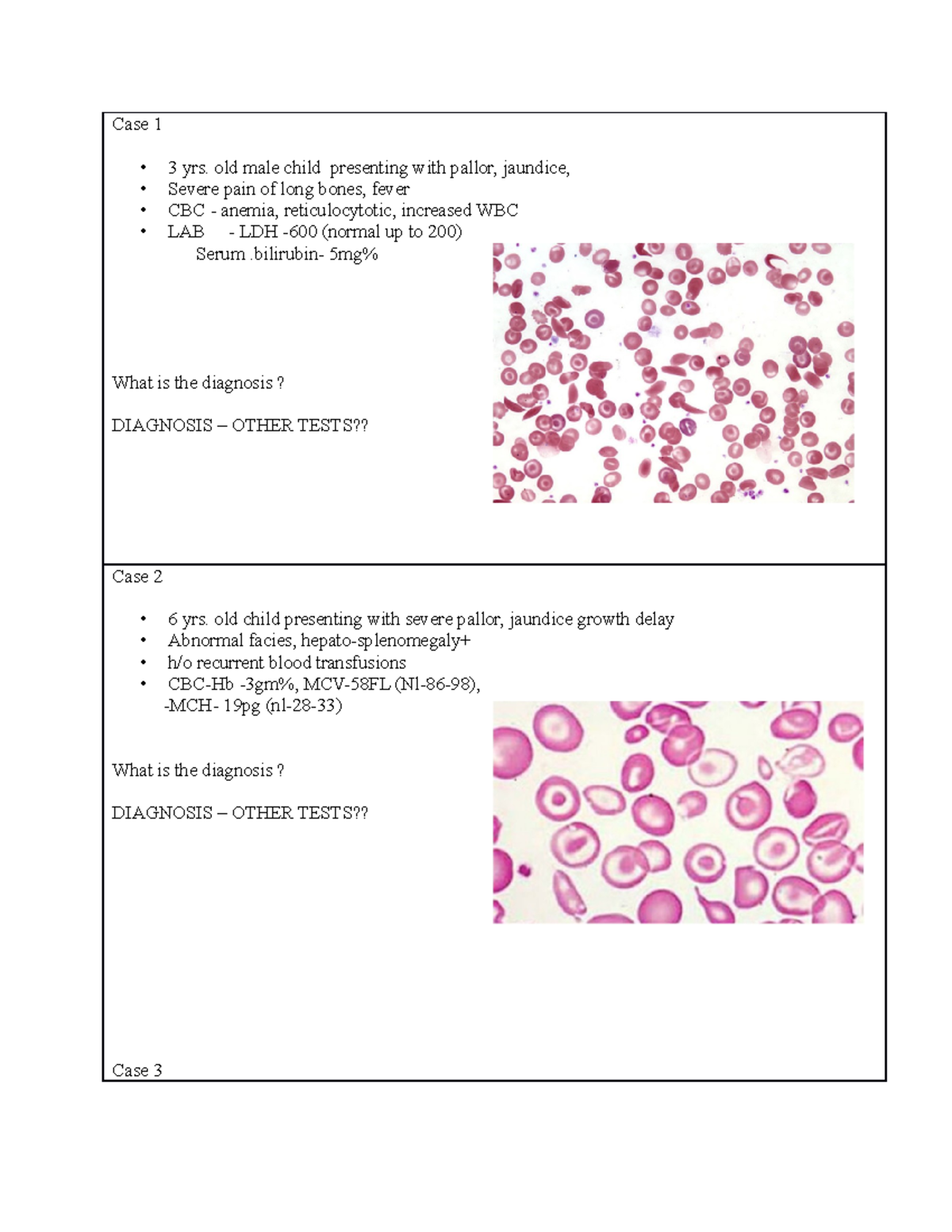 Case 1 كمنيبكمنشي٬ن Case 1 3 yrs. old male child presenting with