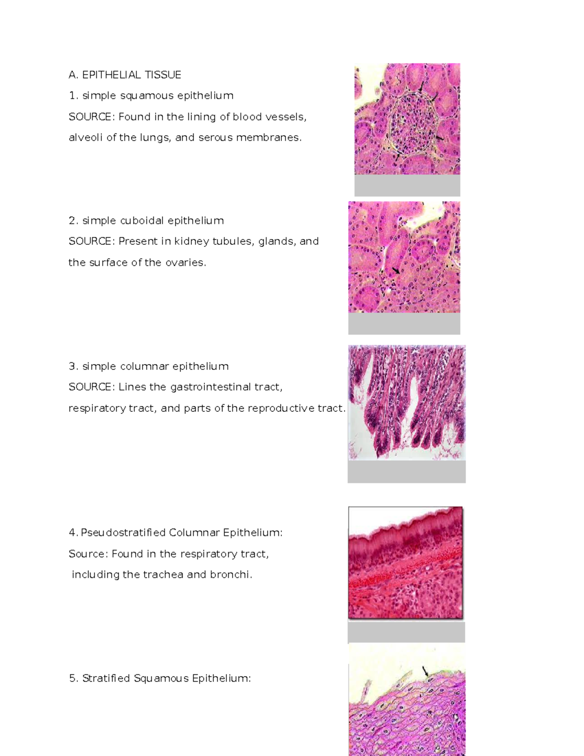 Print- Tissues - REVIEW - A. EPITHELIAL TISSUE simple squamous ...