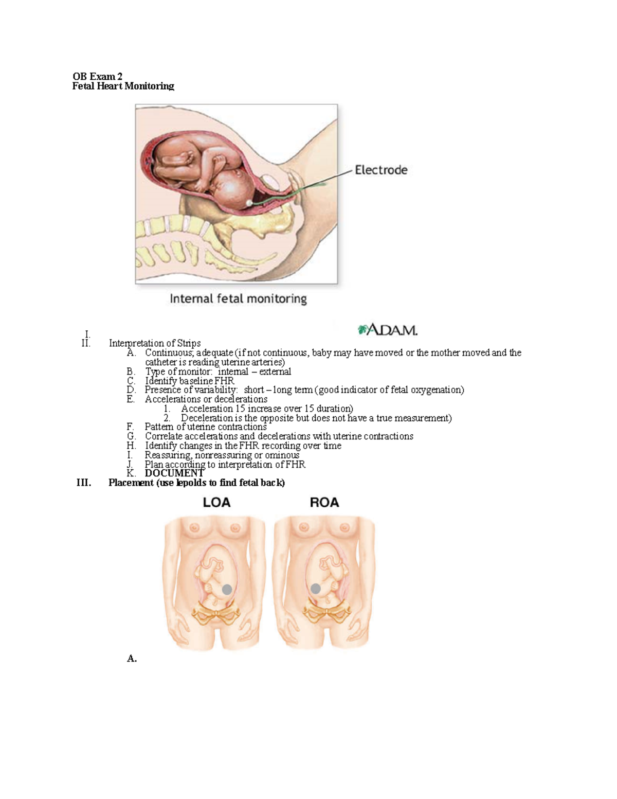 OB Exam 2 summer 2 - OBGYN - OB Exam 2 Fetal Heart Monitoring I. II ...