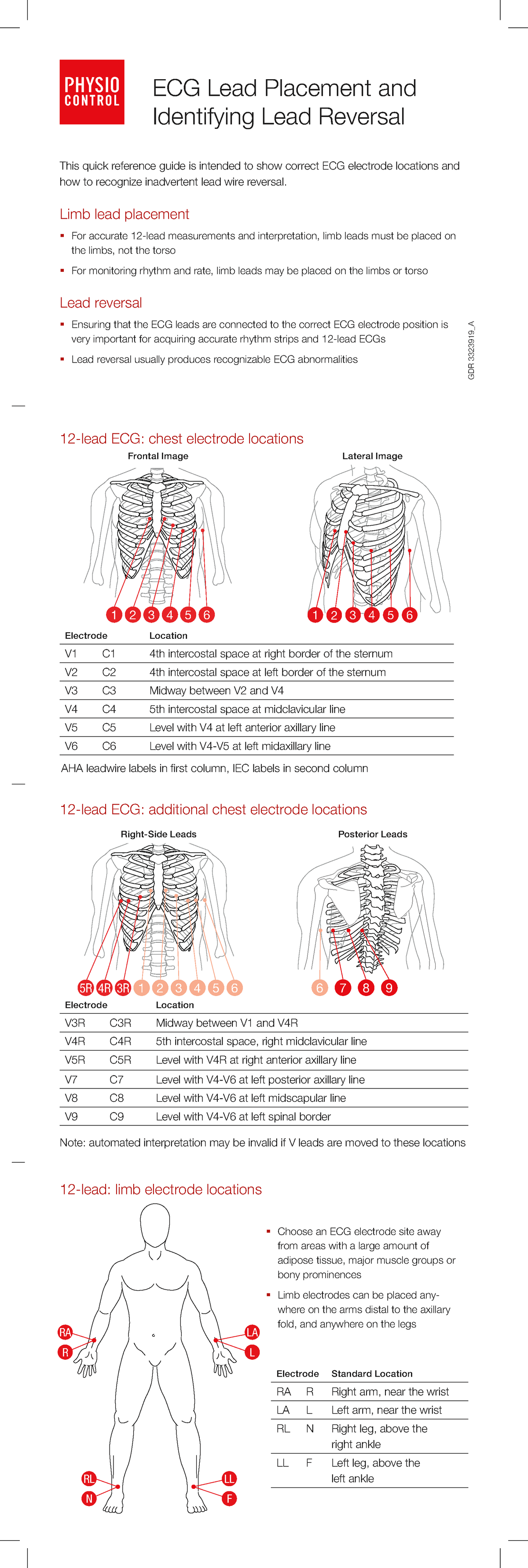 ECG Lead Placement and Lead Reversal Guide - ECG Lead Placement and ...