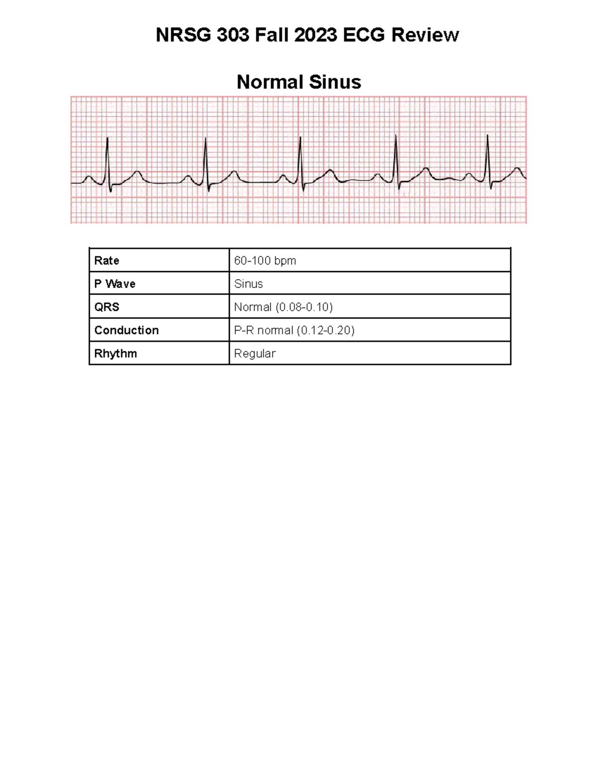 NRSG 303 ECG Handout Fall 23 - NRSG 303 Fall 2023 ECG Review Normal ...