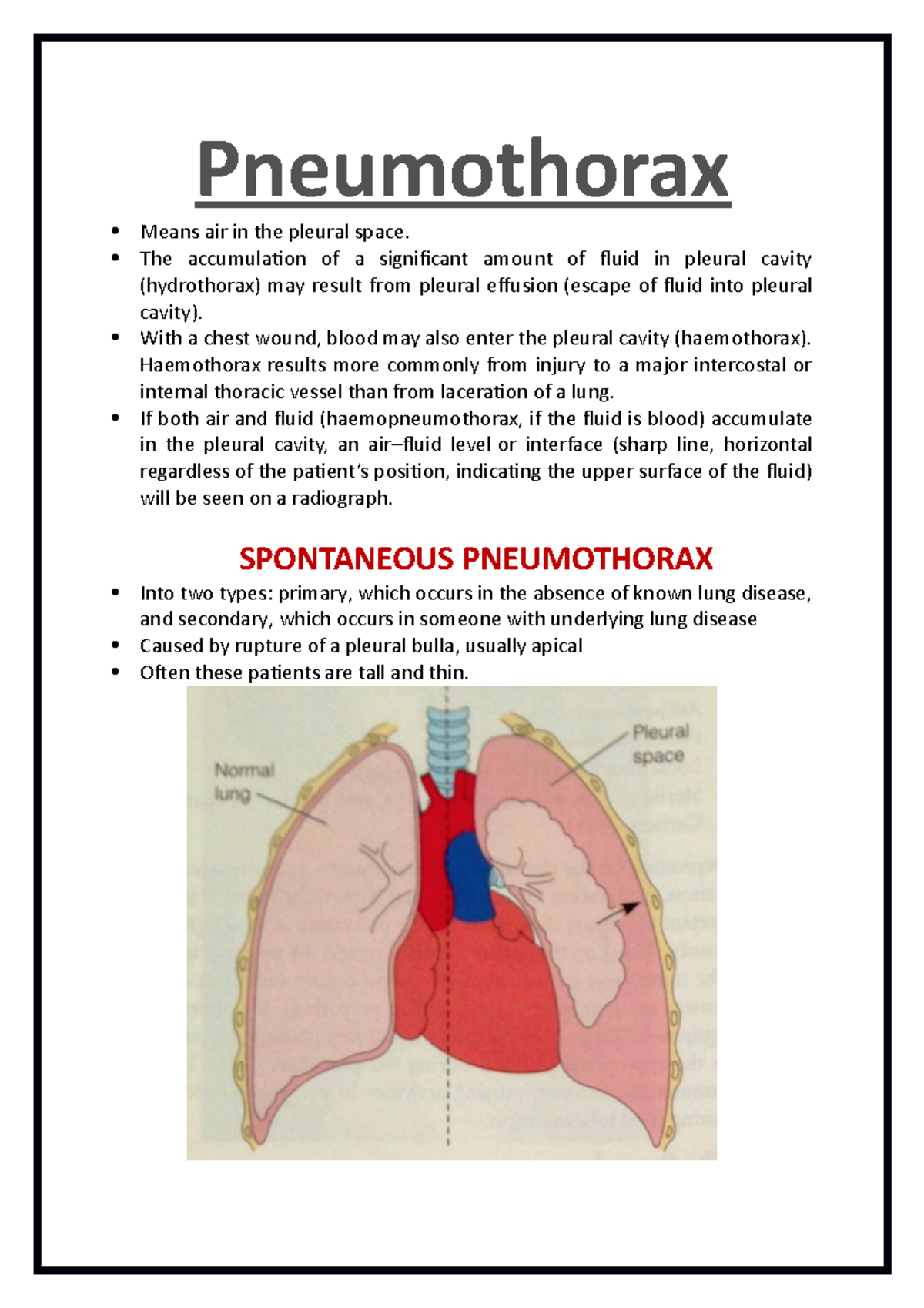 Pneumothorax: Definition, Types And Classification Preview, 43% OFF