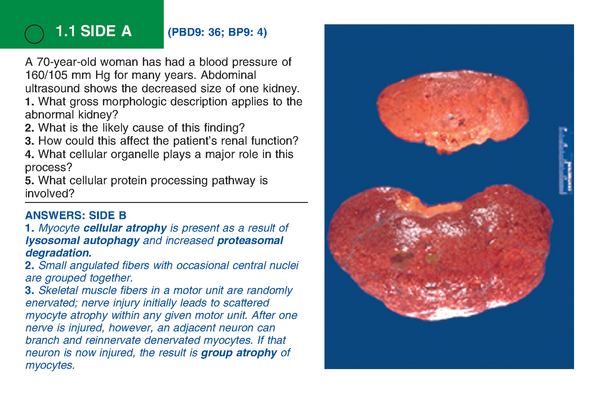 practice-histopathology-a-70-year-old-woman-has-had-a-blood