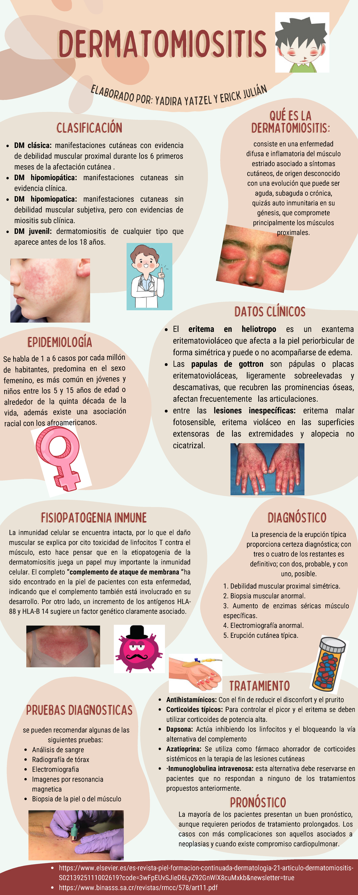 dermatomiositis-apuntes-bonitos-dermatomiositisdermatomiositis