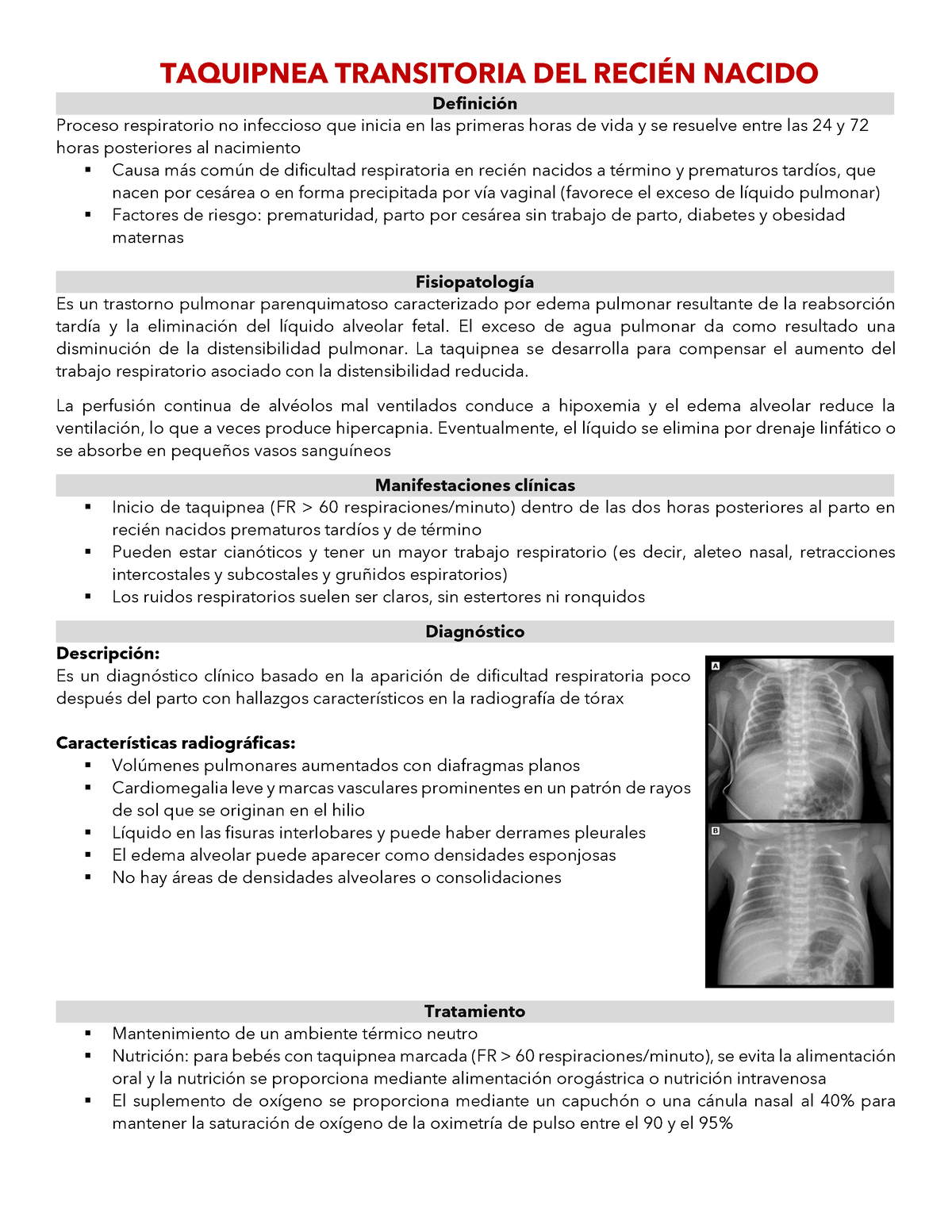 taquipnea transitoria del recién nacido