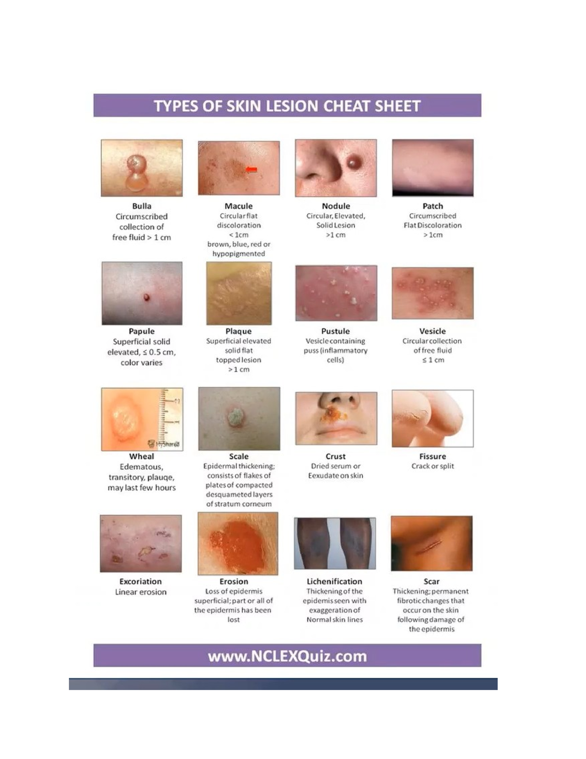 Types of skin lesions NSG 120 - NSG 120 - Studocu