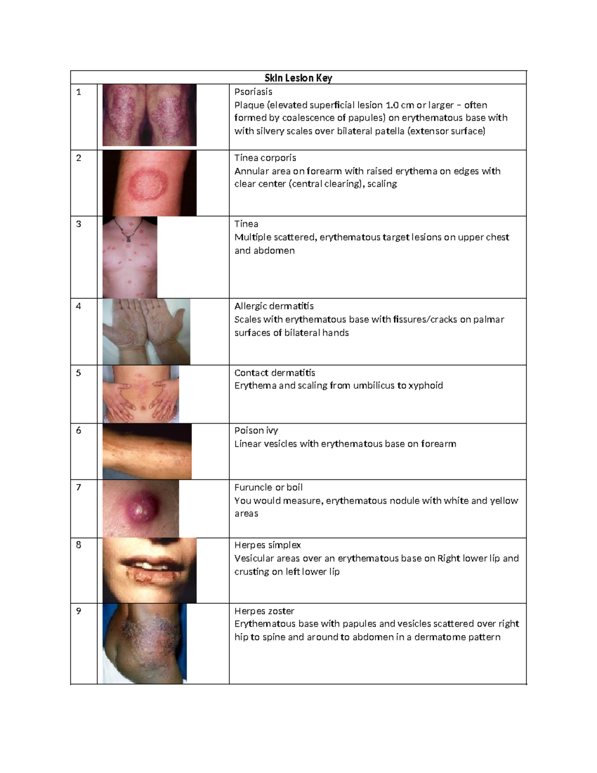 Adult Dermatology Key - Skin Lesion Key 1 Psoriasis Plaque (elevated ...