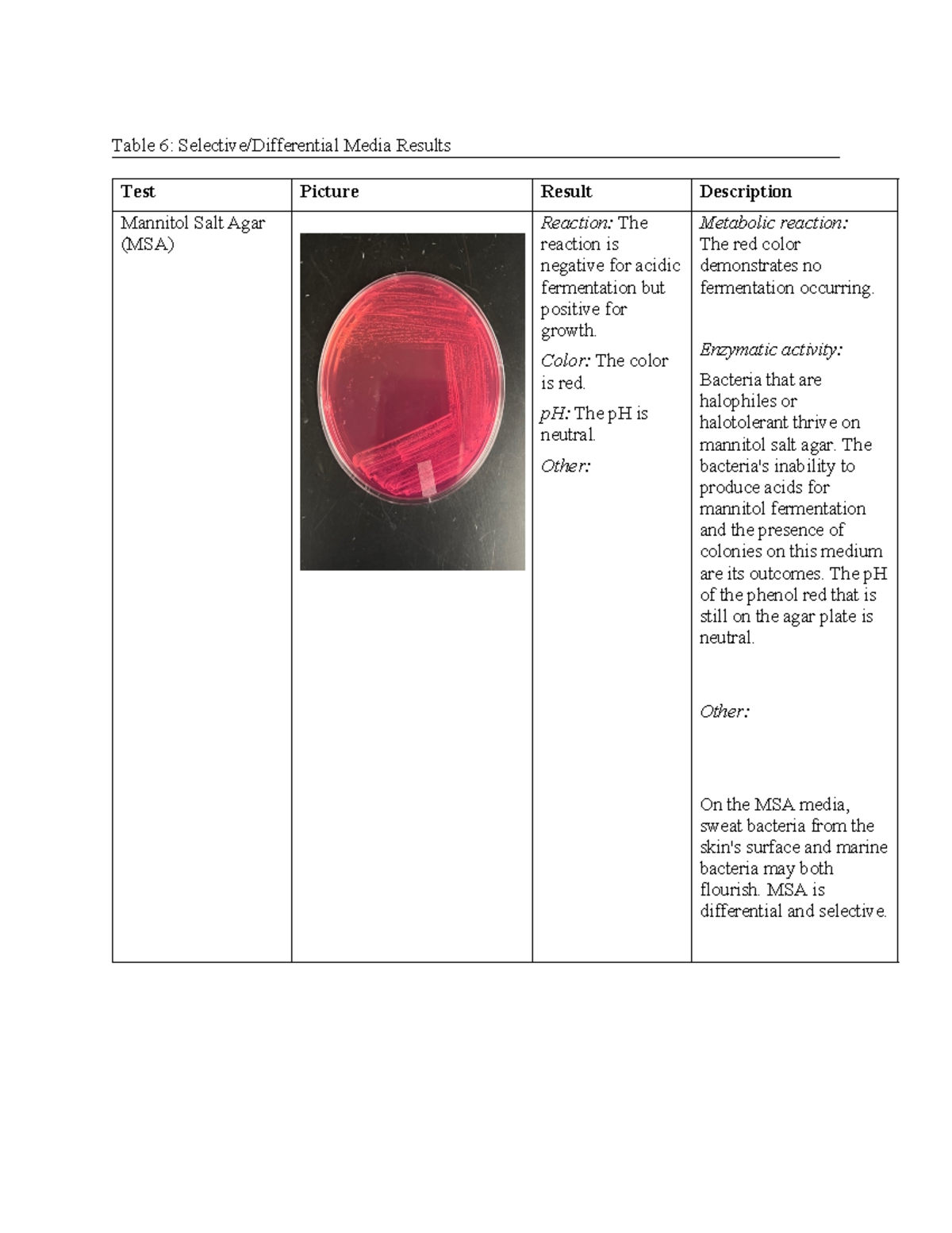 Class Activity 6 Lab Table 6 Selective/Differential Media Results