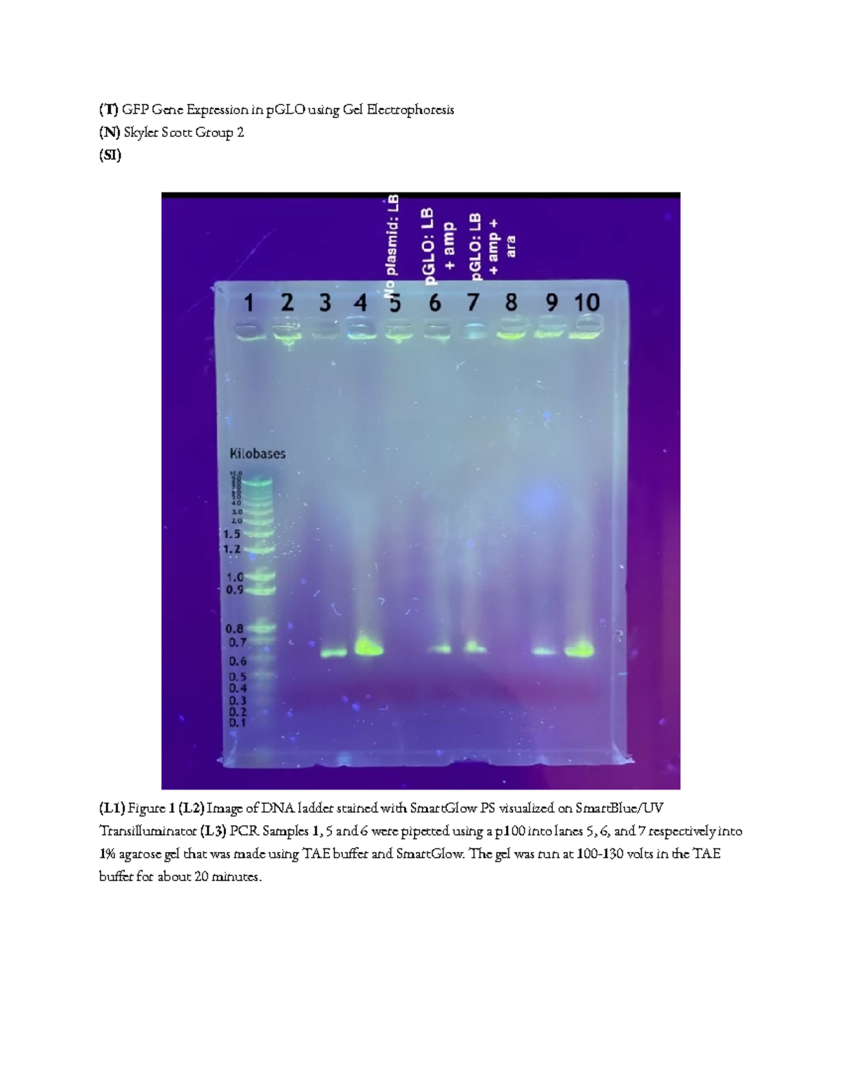 BIOL 113 Lab 10 Report (T) GFP Gene Expression in pGLO using Gel