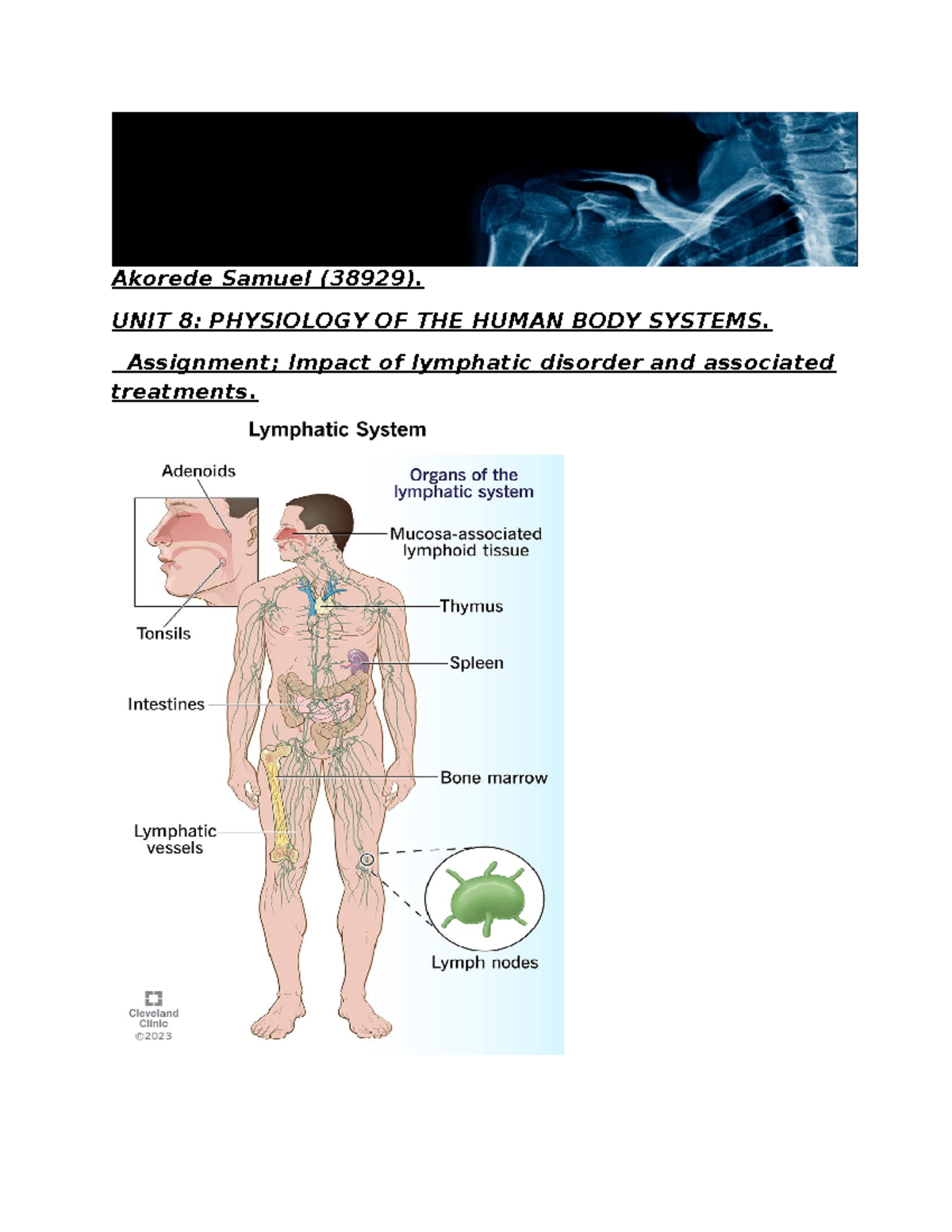 Unit 81 Biology unit 8 lymphatic system disorders. Akorede Samuel