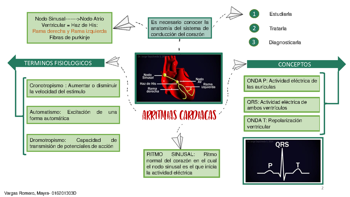 Electrocardiograma 3 Y 4 Mapas Mentales - Es Necesario Conocer La ...