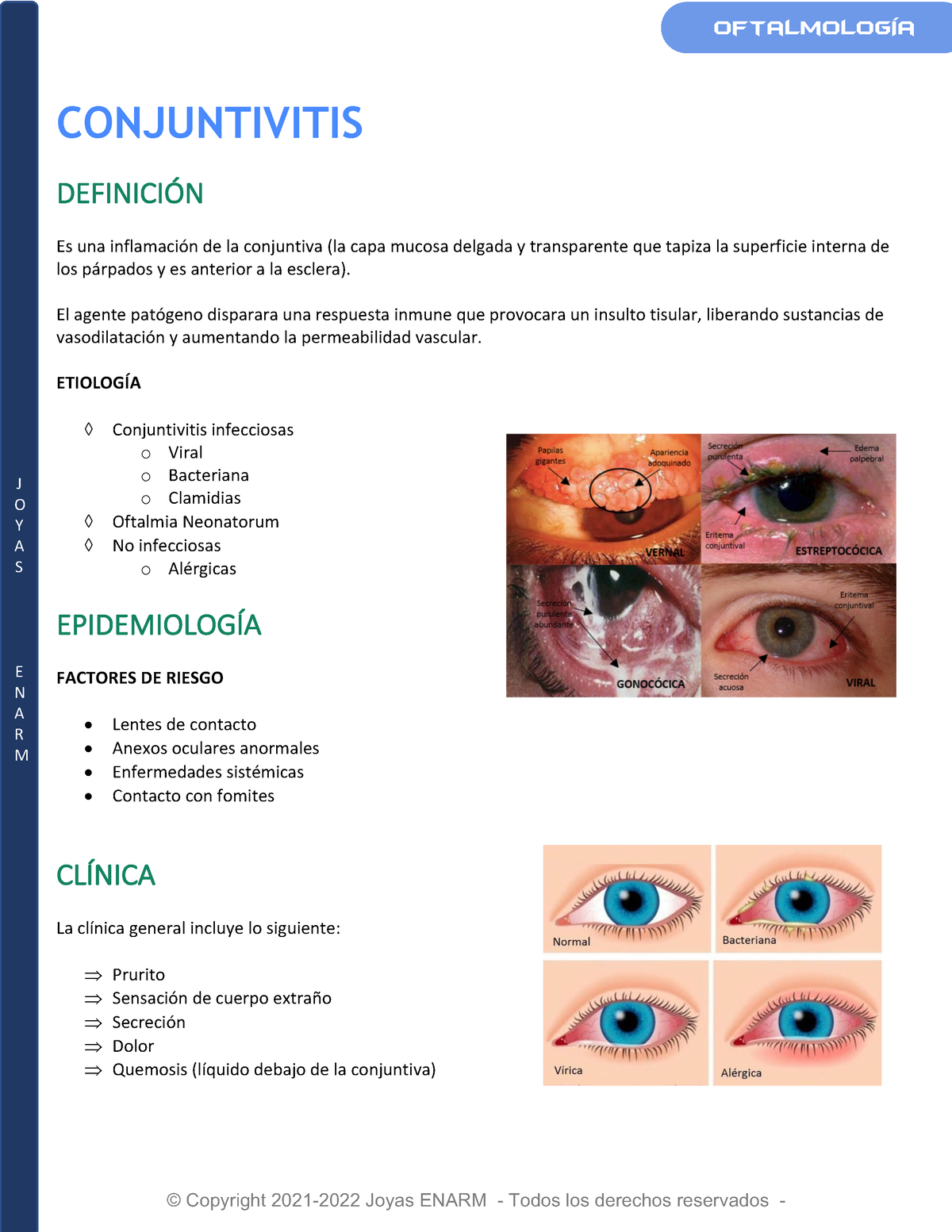 14 Conjuntivitis J O Y A S E N A R M Conjuntivitis DefiniciÓn Es Una Inflamación De La 7481