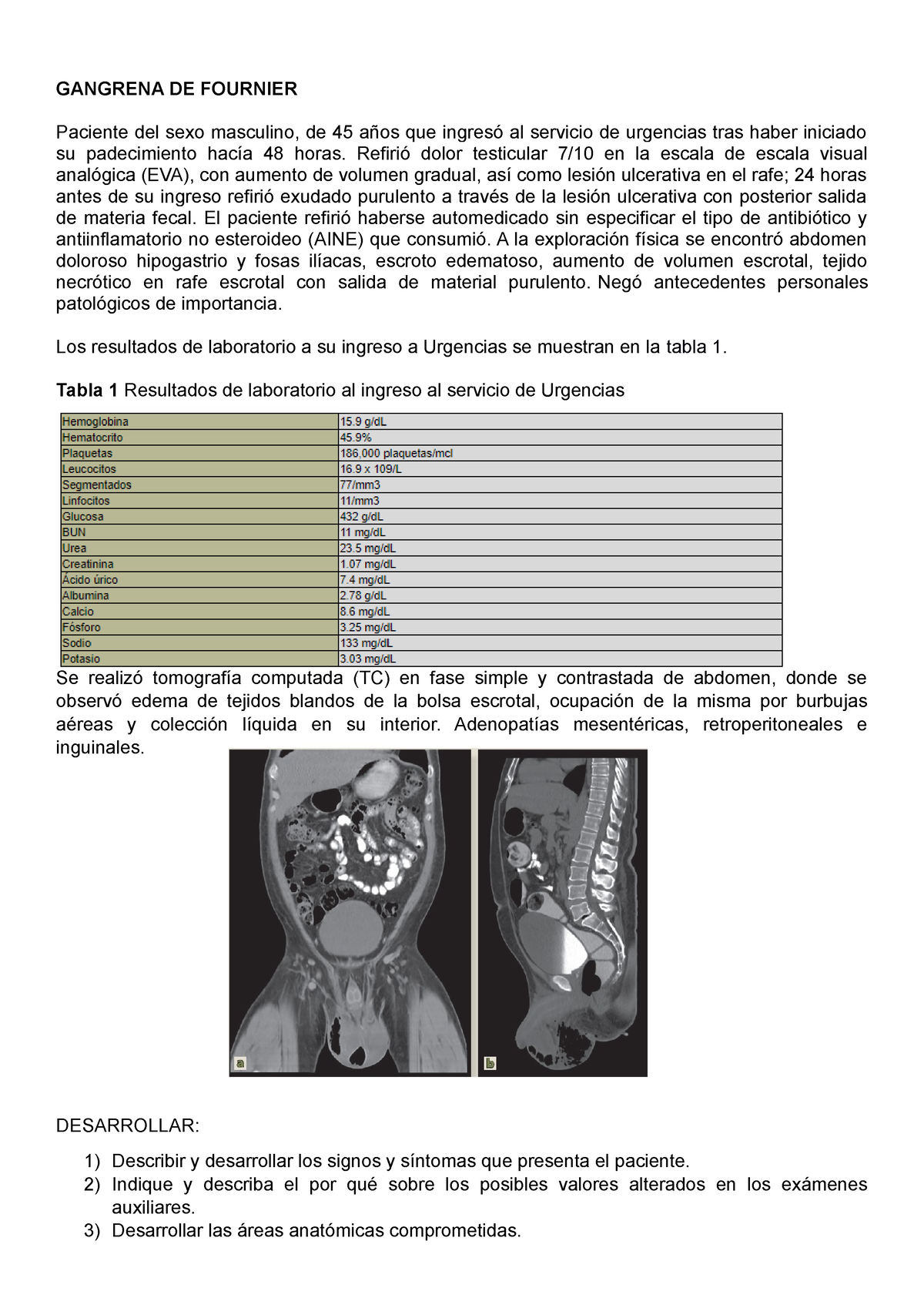 Gangrena DE Fournier GANGRENA DE FOURNIER Paciente del sexo masculino de años que ingresó