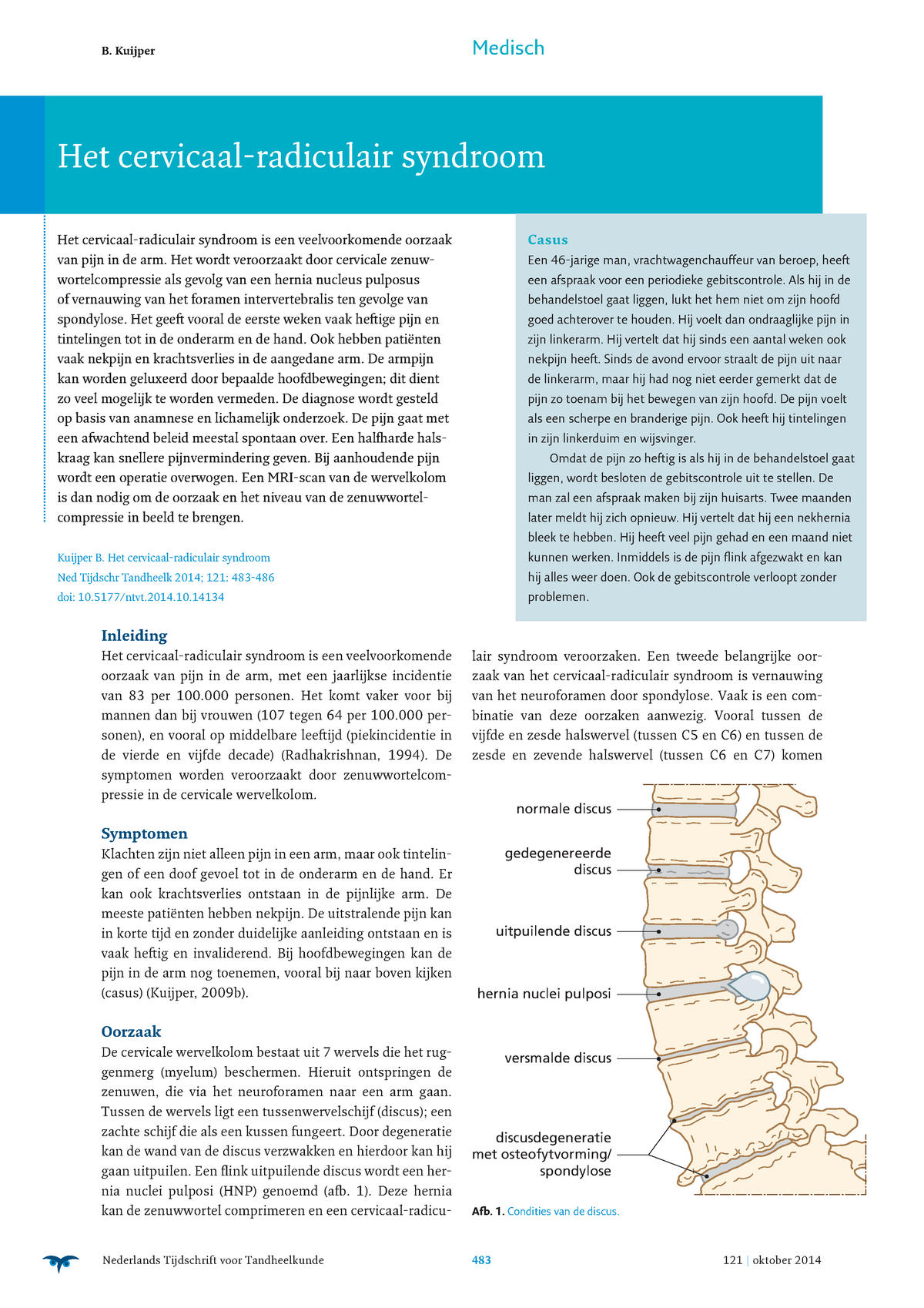 Het Cervicaal Radiculair Syndroom Studeersnel