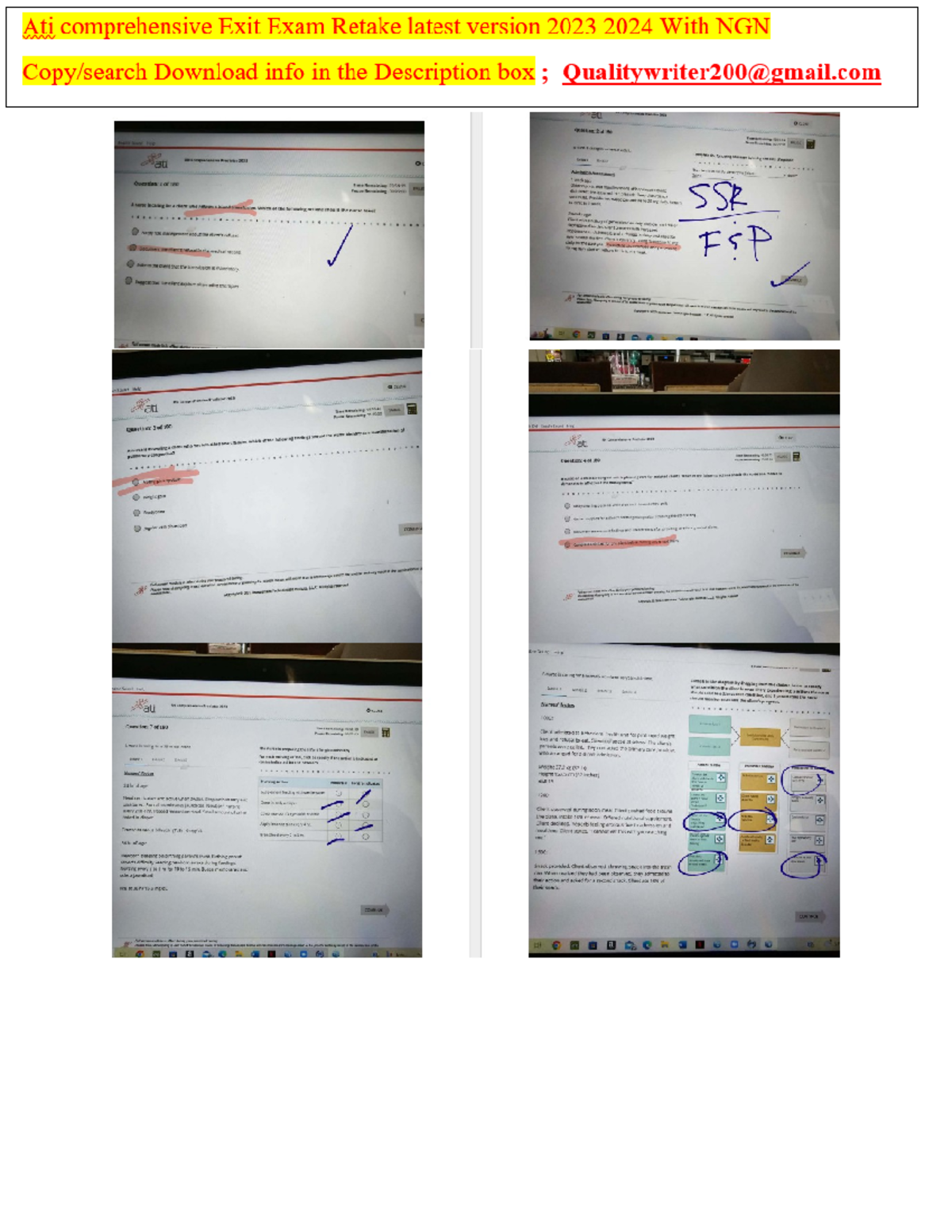 ATI Comprehensive Predictor 2023 Exam Retake with NGN Updated Version