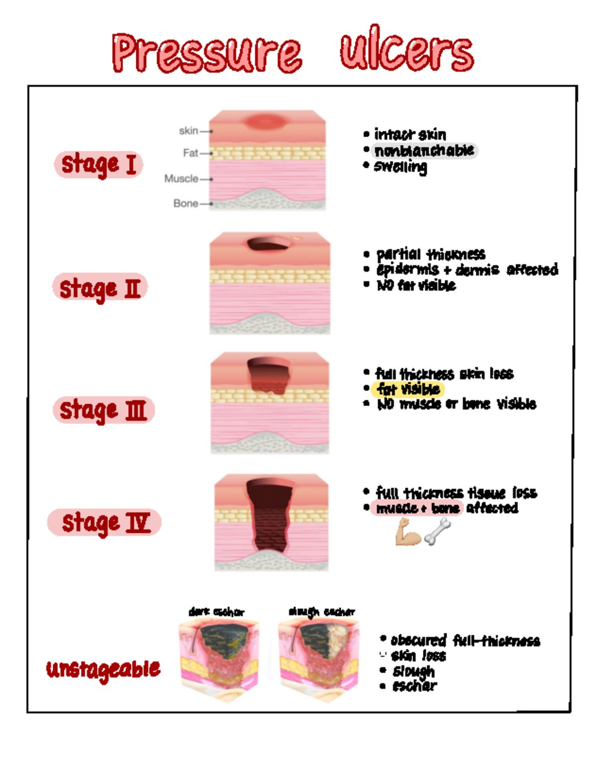 Pressure Ulcers - Notes - BI13 - Studocu