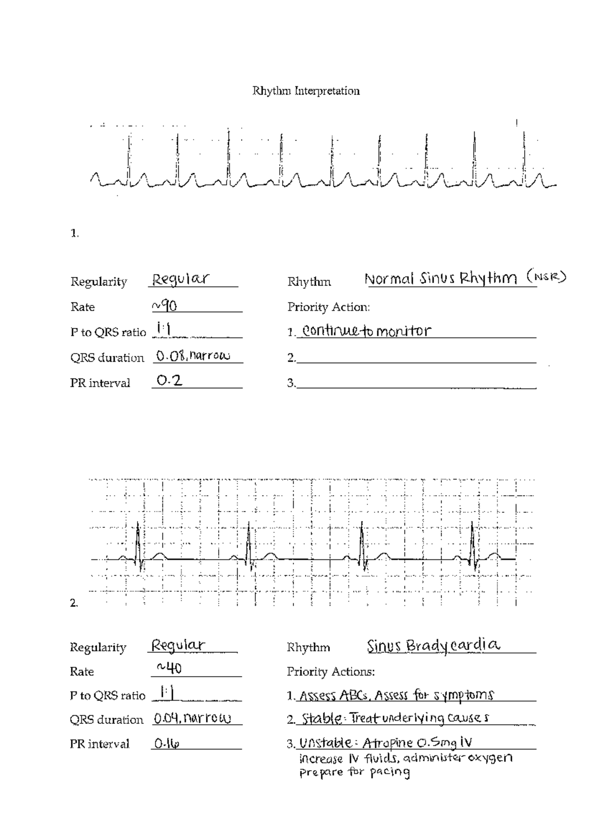 Lecture Notes For Adult Health II - Adult hth II - Studocu