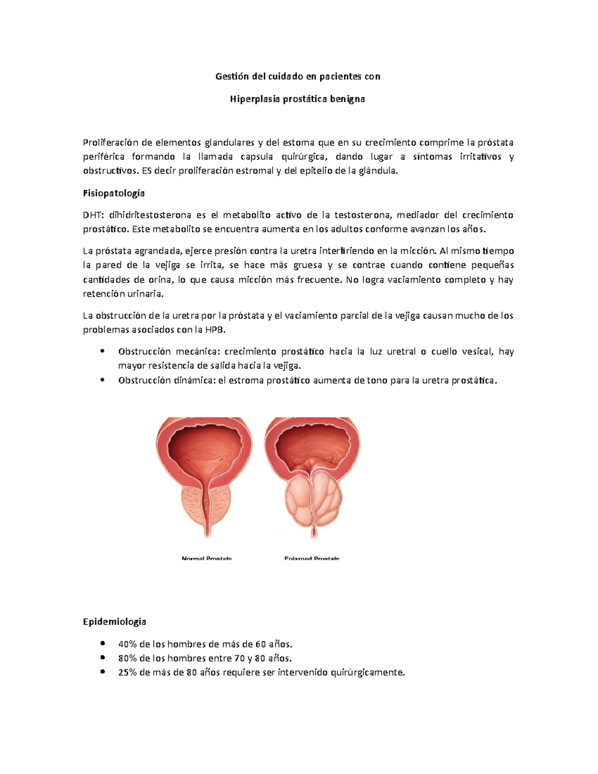 Próstata agrandada de 25 años
