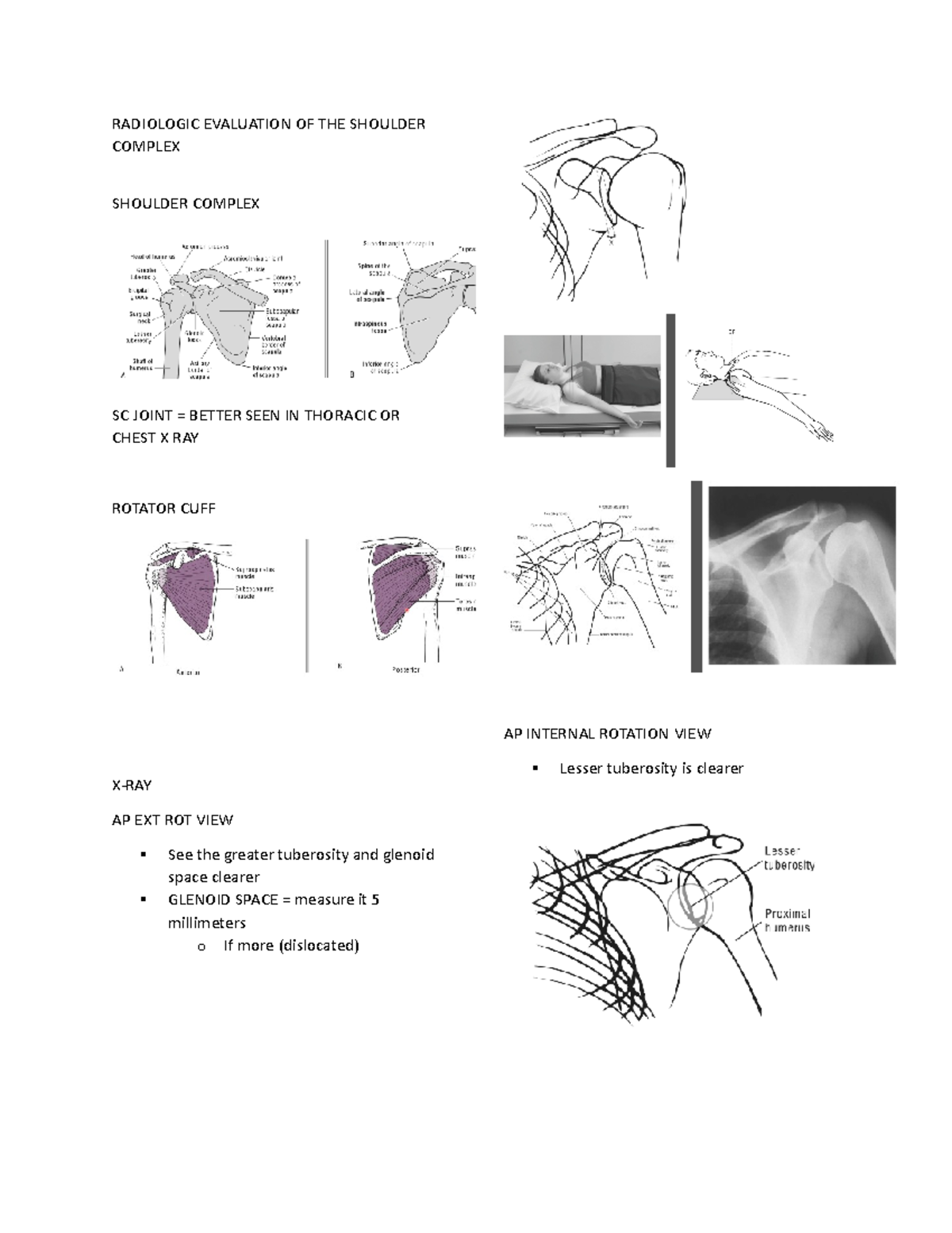 Radiologic Evaluation OF THE Shoulder Complex - RADIOLOGIC EVALUATION ...