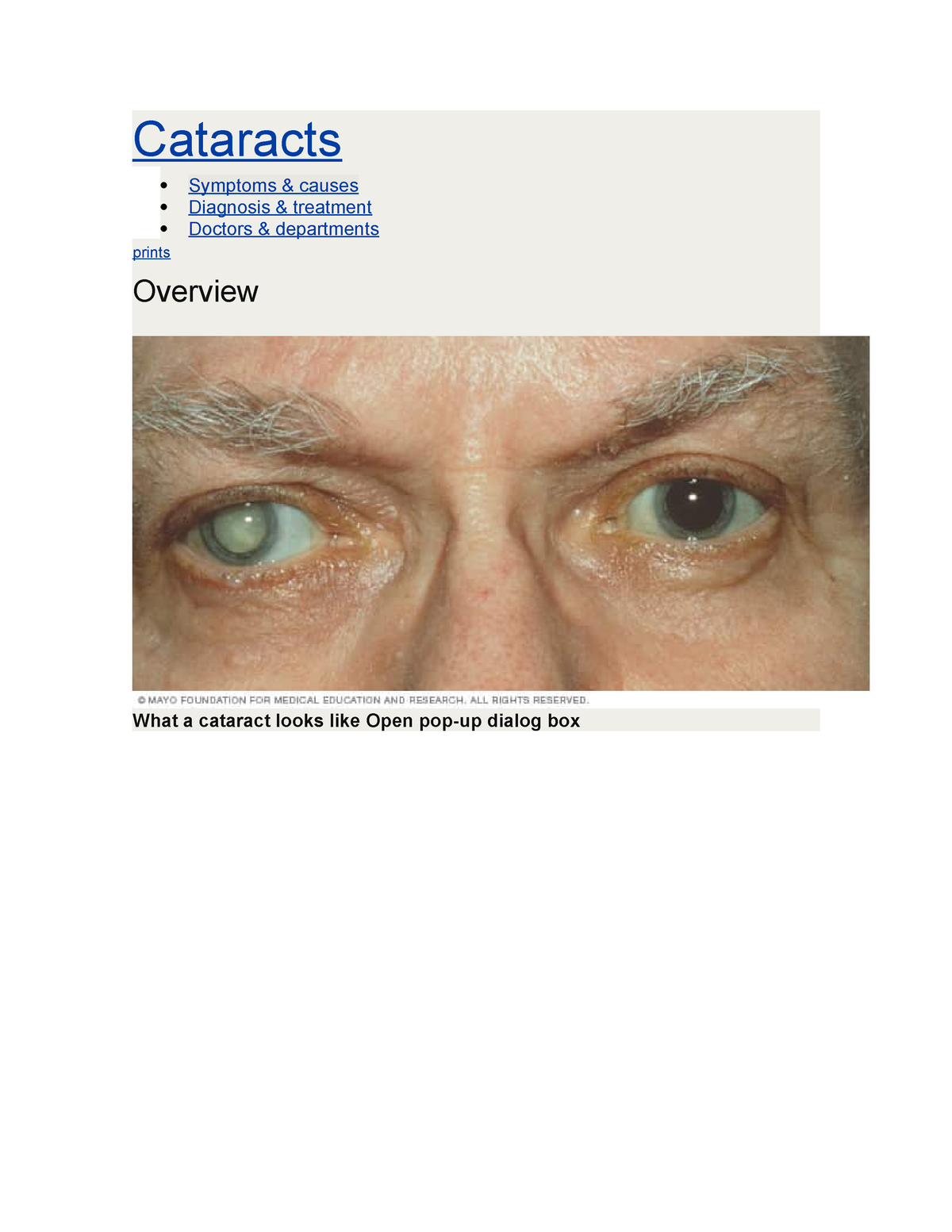 Cataracts - Bbbbb - Cataracts Symptoms & Causes Diagnosis & Treatment ...