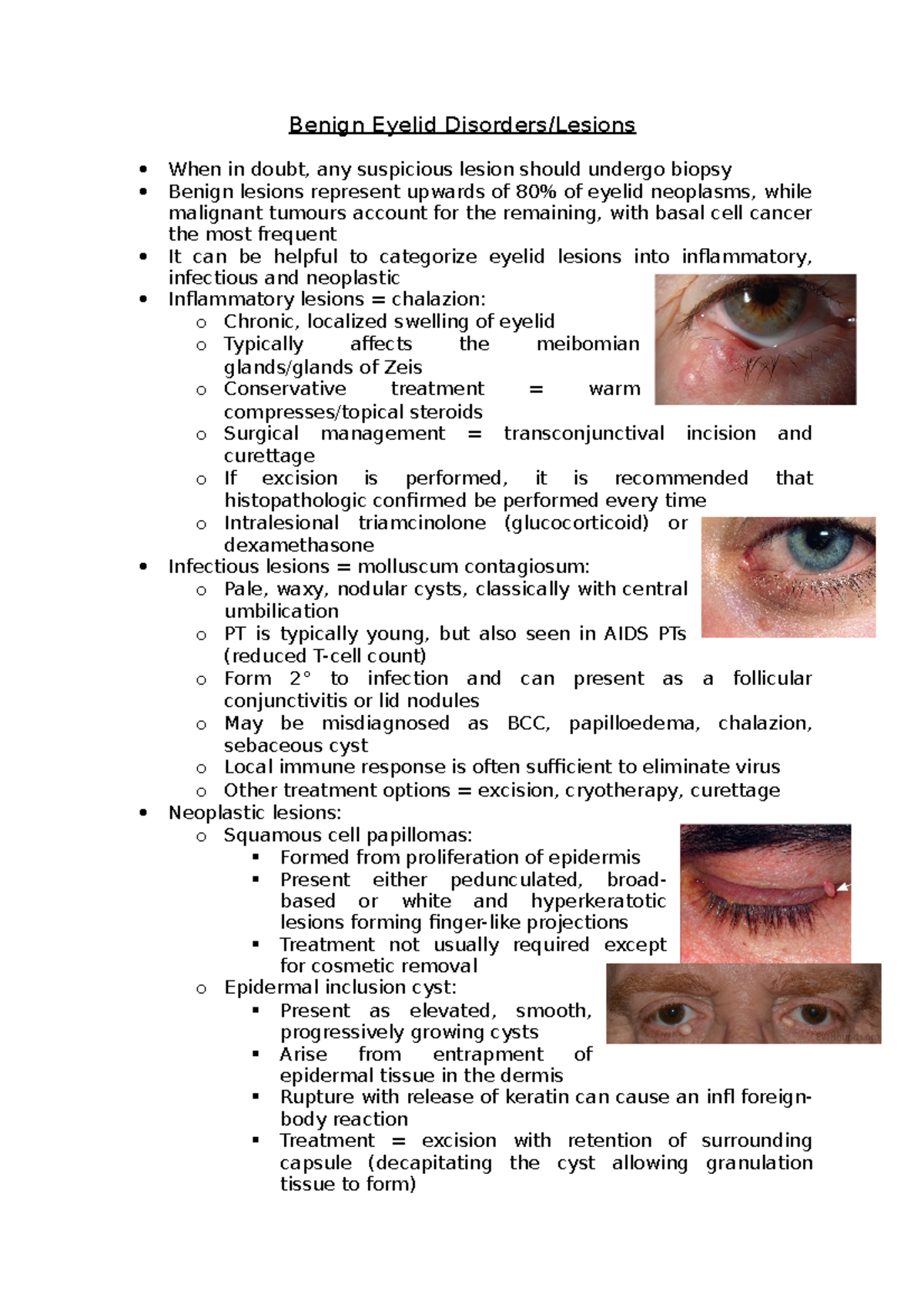 Benign Eyelid Disorders - Benign Eyelid Disorders/Lesions When In Doubt ...