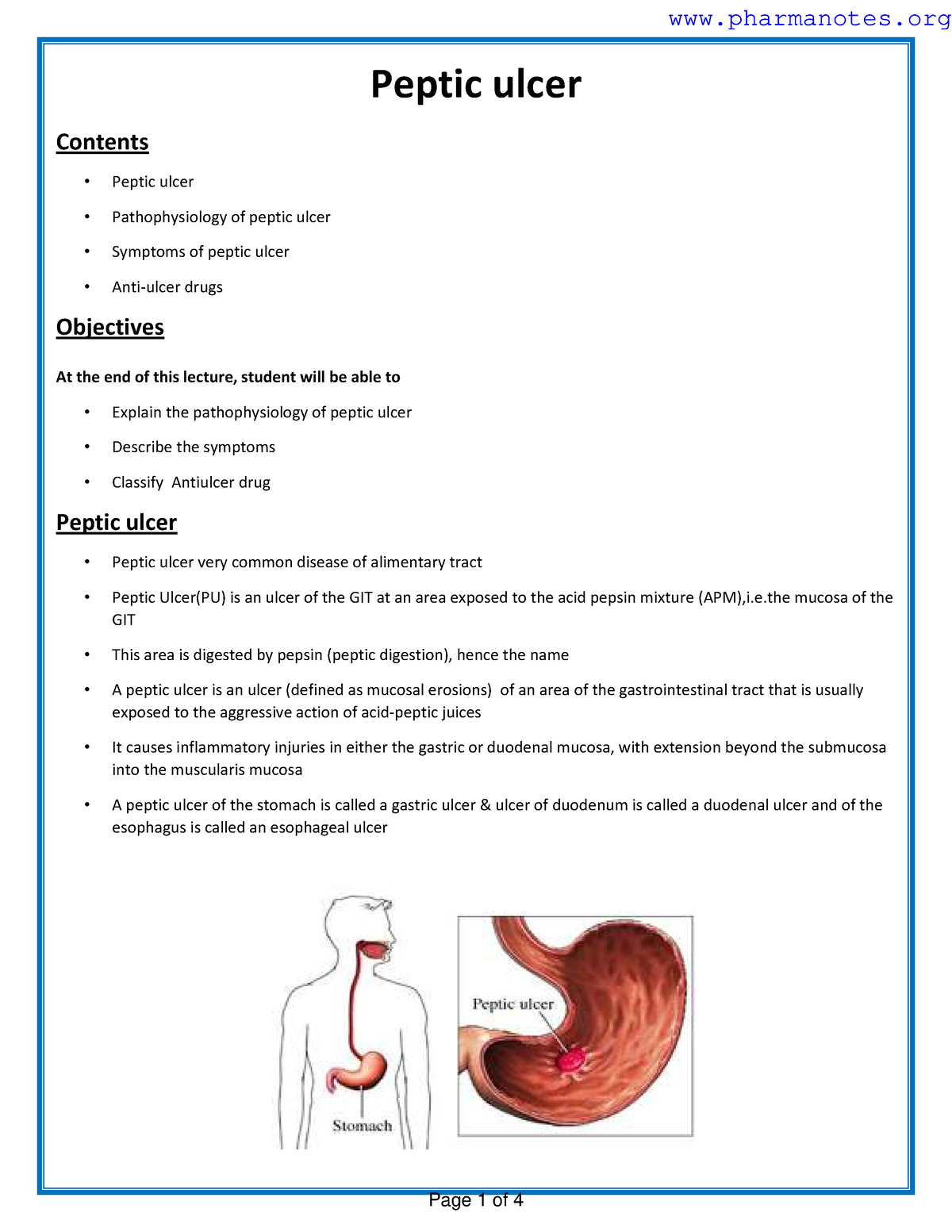 Pathophysology Of Ulcer - Peptic Ulcer Contents Peptic Ulcer ...