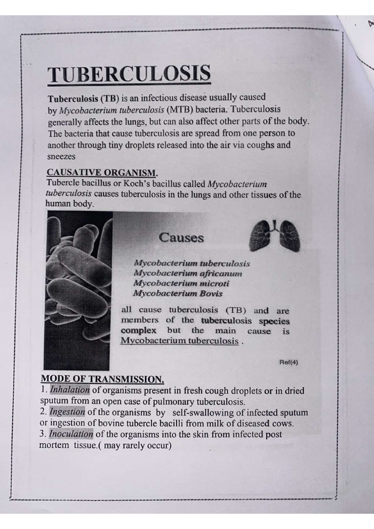 Tuberculosis - Simple Notes To Score Very High Score.. - Pharmacy - Studocu