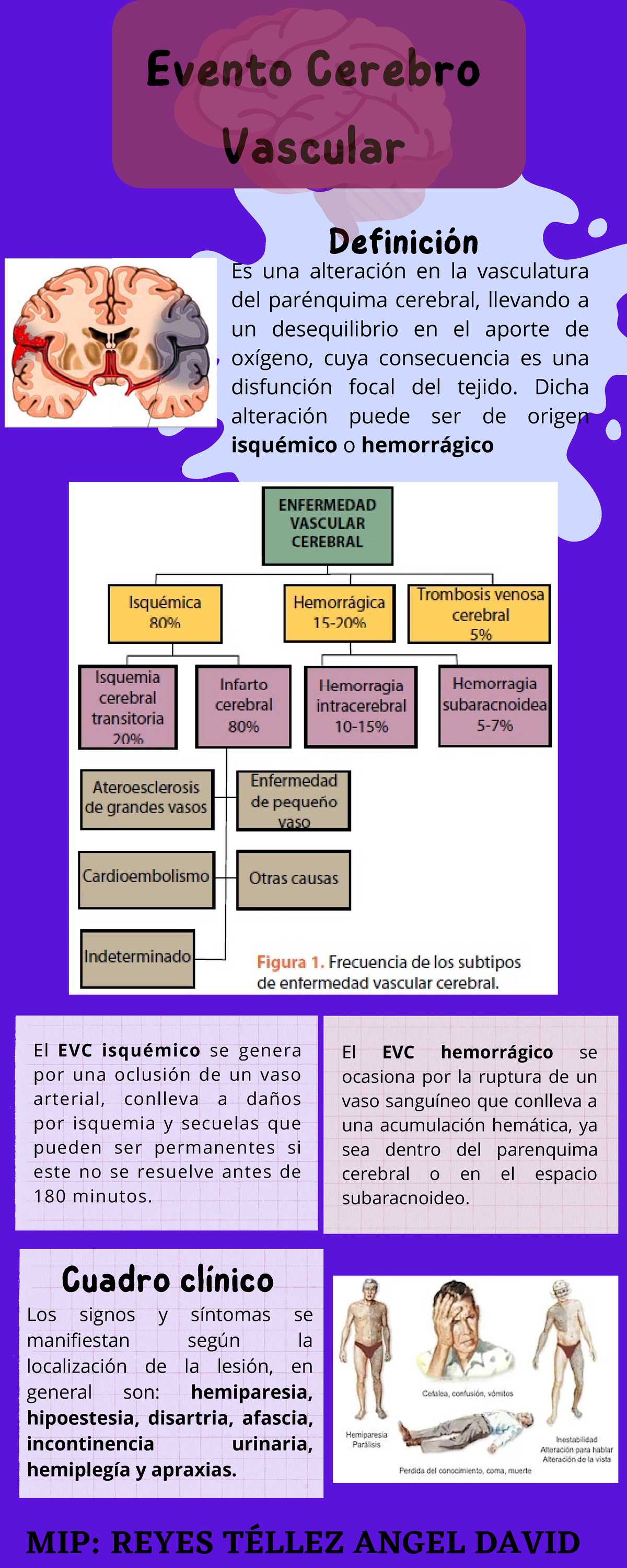 Evento Cerebro Vascular - Evento Cerebro Vascular Es una alteración en