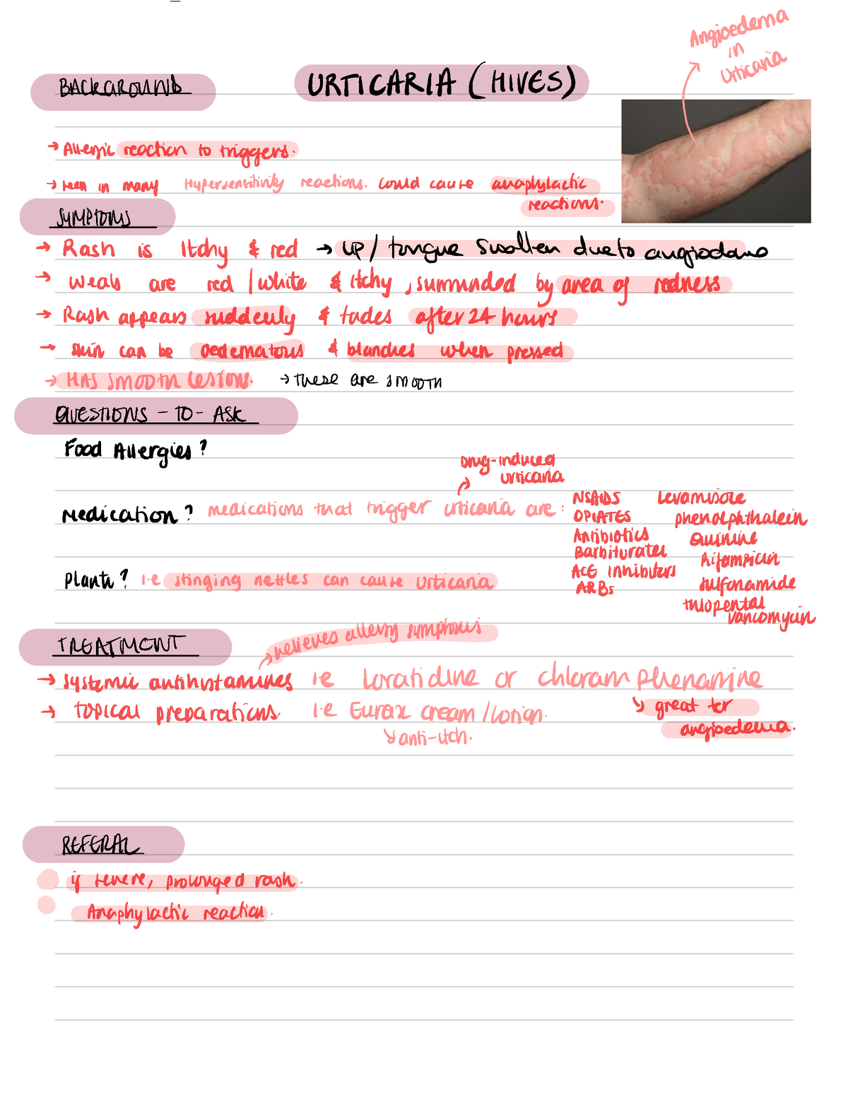 OSCE-Urticaria notes - BACKGROUND ####### URTICARIA ( Hives ) fm&%f%?L ...