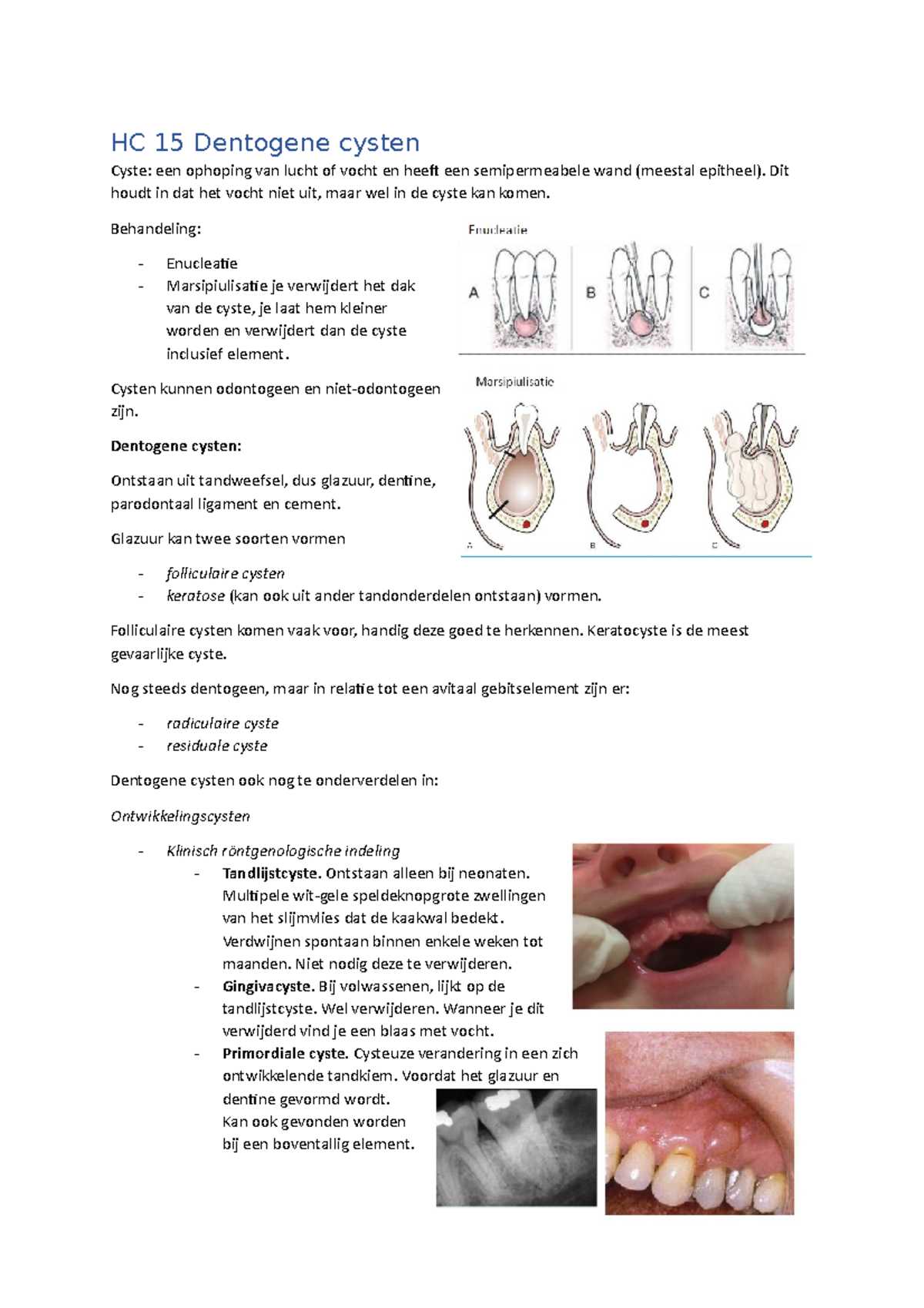 Samenvatting colleges Cysten - HC 15 Dentogene cysten Cyste: een ...