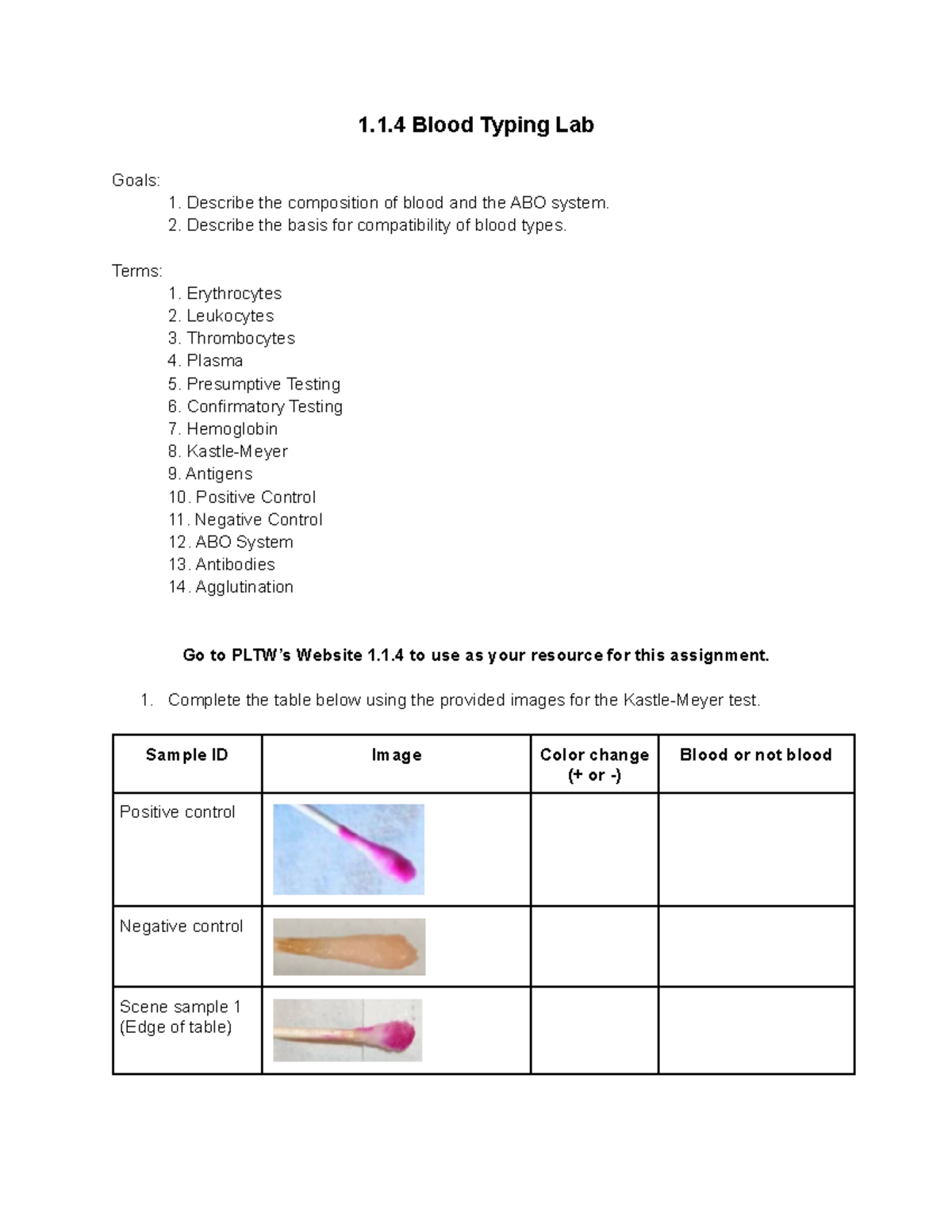 Compatibility Of Blood Types: ABO Blood Group System - Lab Me