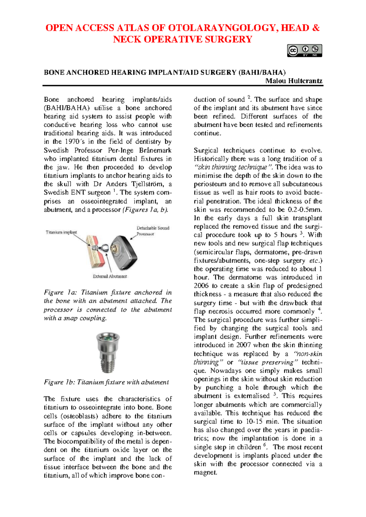 Bone anchored hearing implant aid BAHI BAHA surgery - OPEN ACCESS ATLAS ...