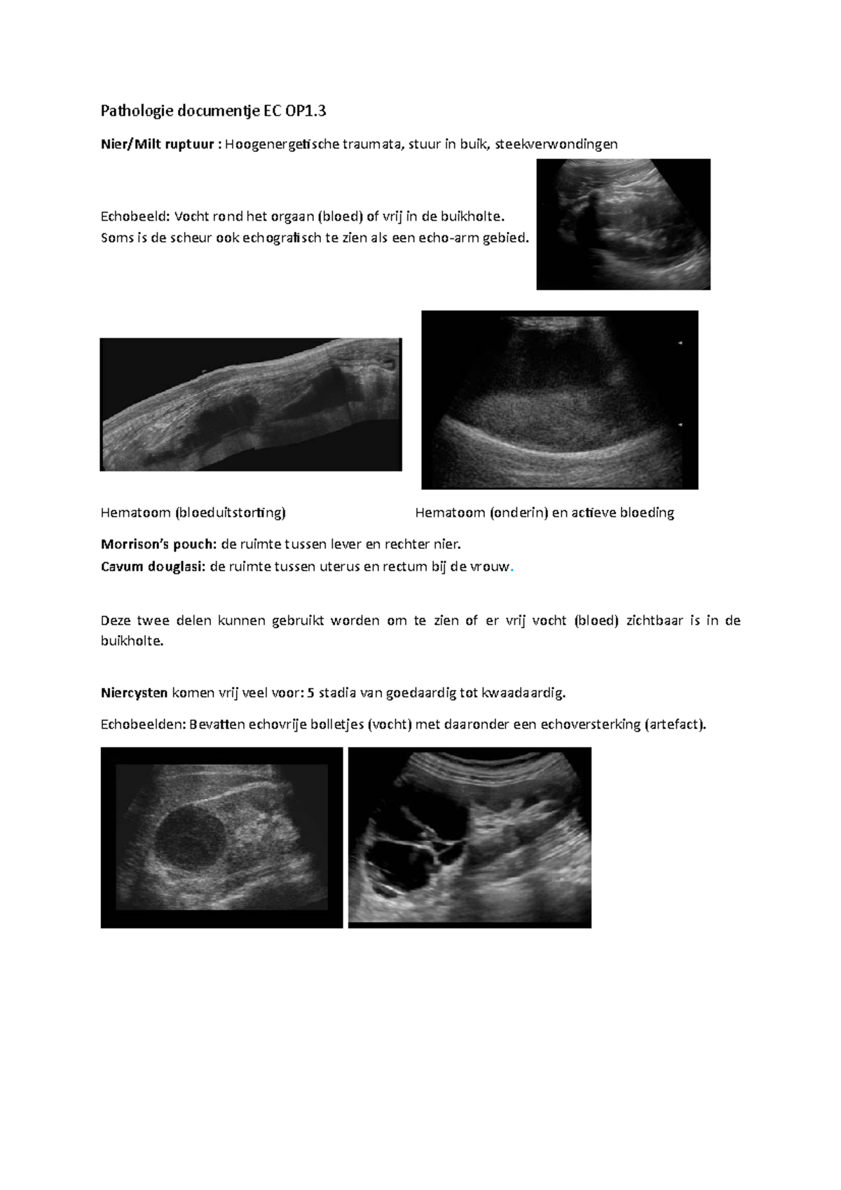 EC OP1.3 Echo Pathologie Pathologie documentje EC OP1. Nier/Milt ruptuur Hoogenergetische EC OP1.3 Echo Pathologie Pathologie documentje EC OP1. Nier/Milt ruptuur Hoogenergetische