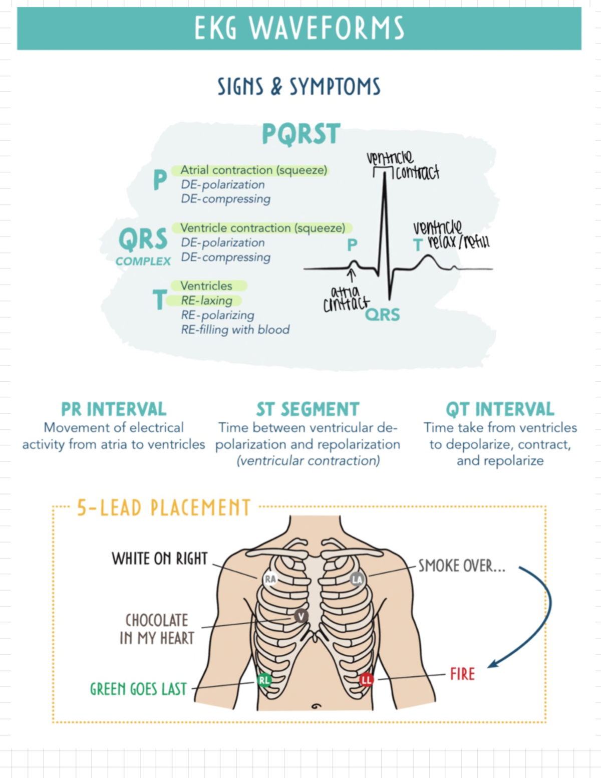 dysthymias-dysrhythmias-dysrhythmias-normal-sinus-rhythm-originates